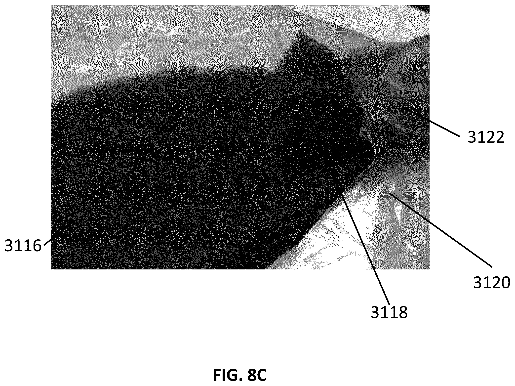 Patent US12097096 Figure 12 – Customizable wound closure device and method of use
