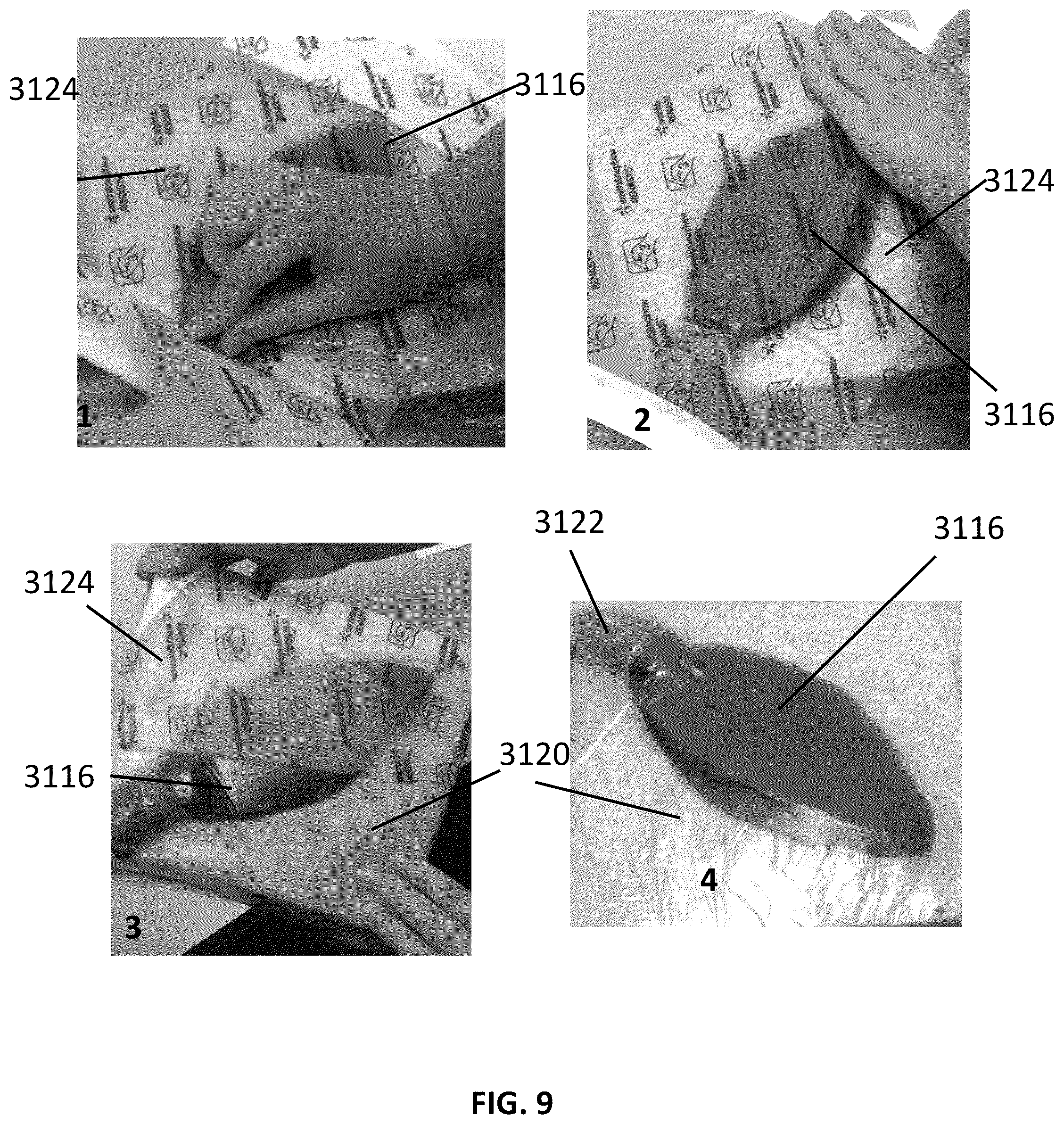 Patent US12097096 Figure 13 – Customizable wound closure device and method of use