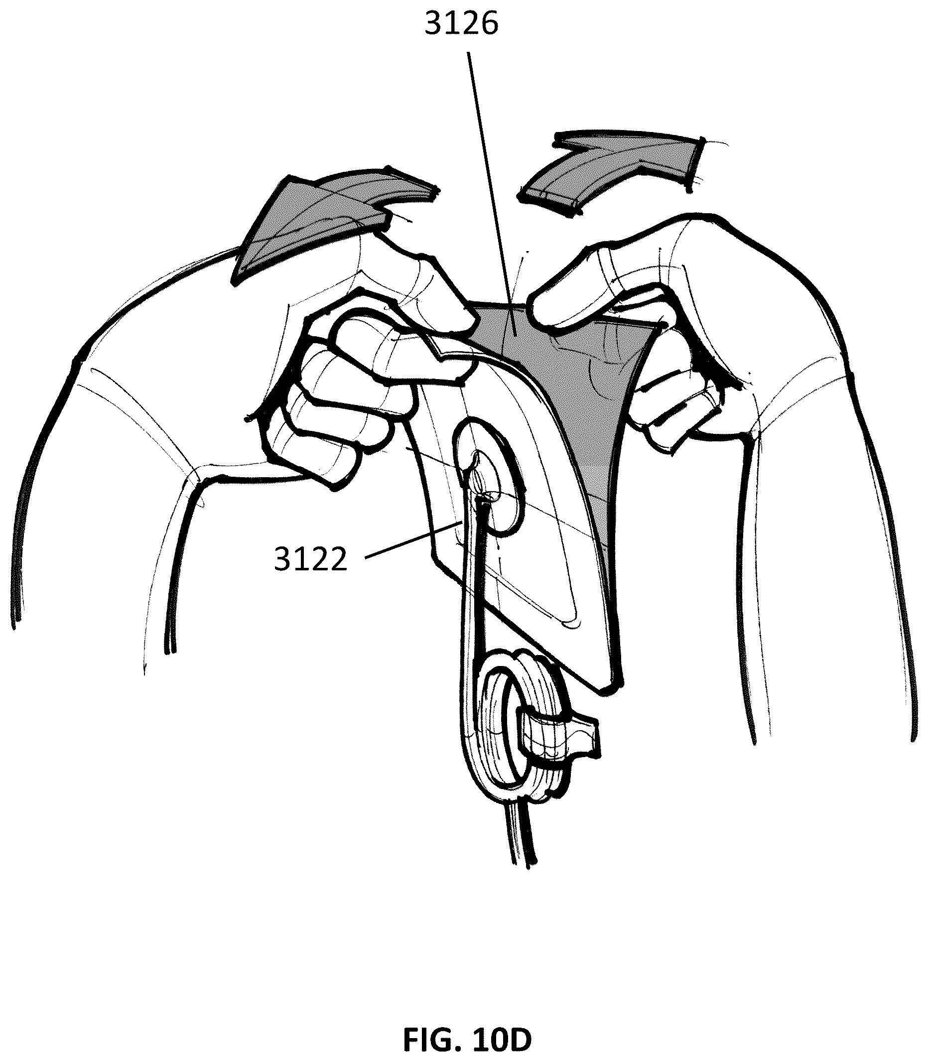 Patent US12097096 Figure 17 – Customizable wound closure device and method of use