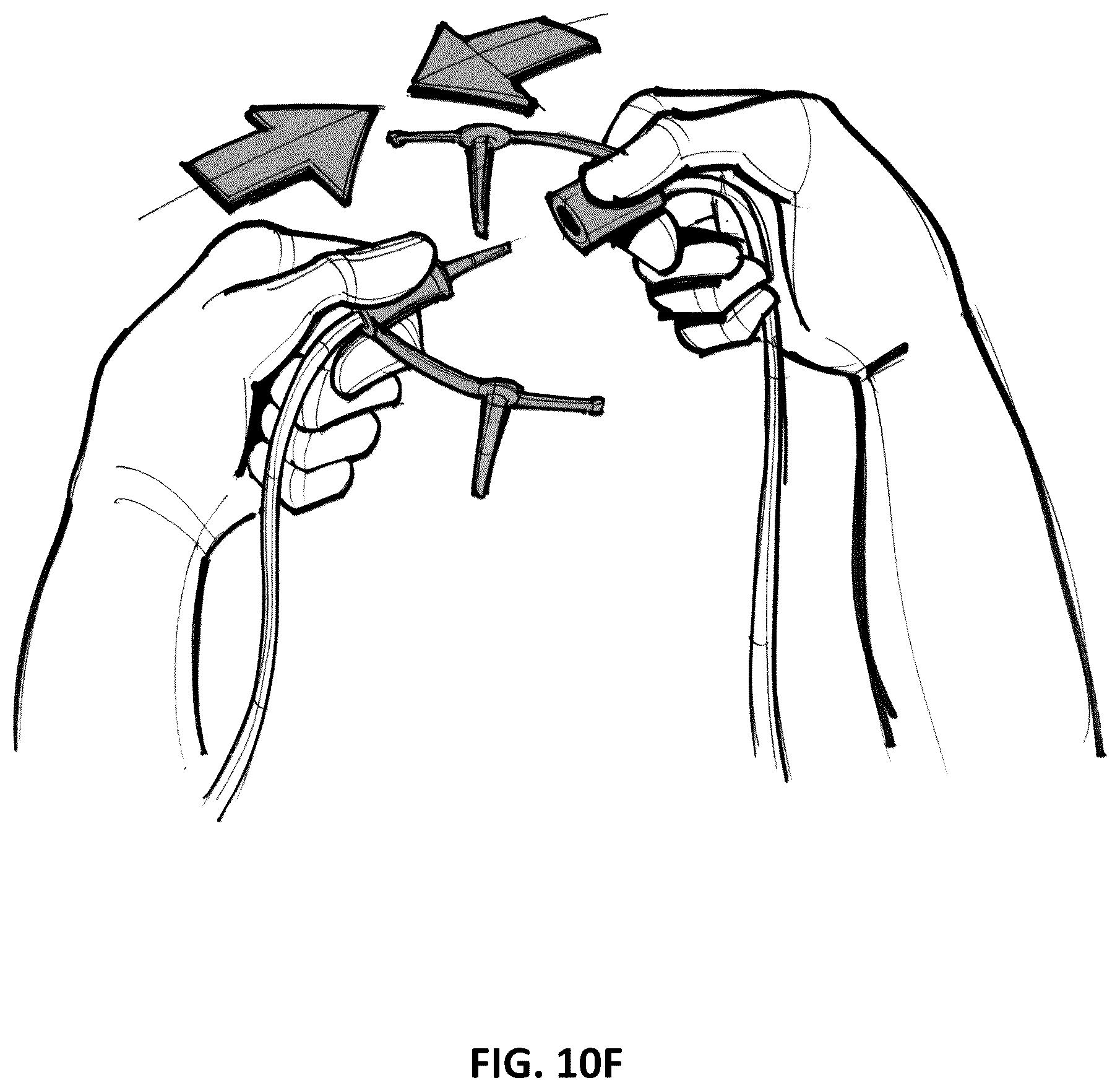 Patent US12097096 Figure 19 – Customizable wound closure device and method of use