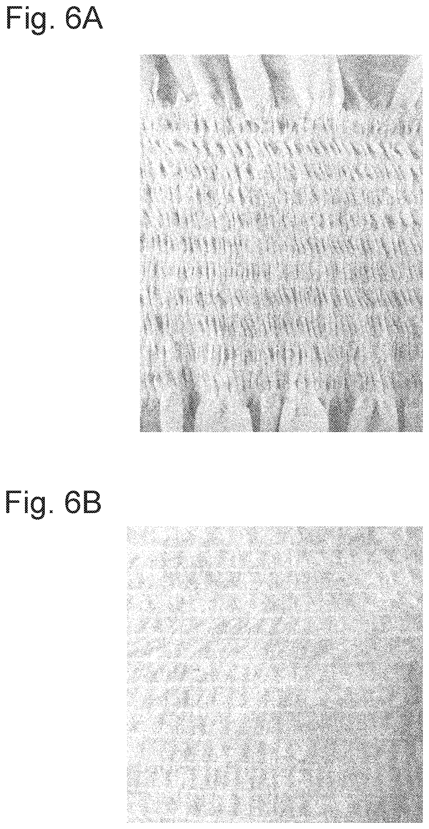 Patent US12097099 Figure 5 – Production method of elastic composite sheet, elastic composite sheet, and disposable wearable article using said elastic composite sheet