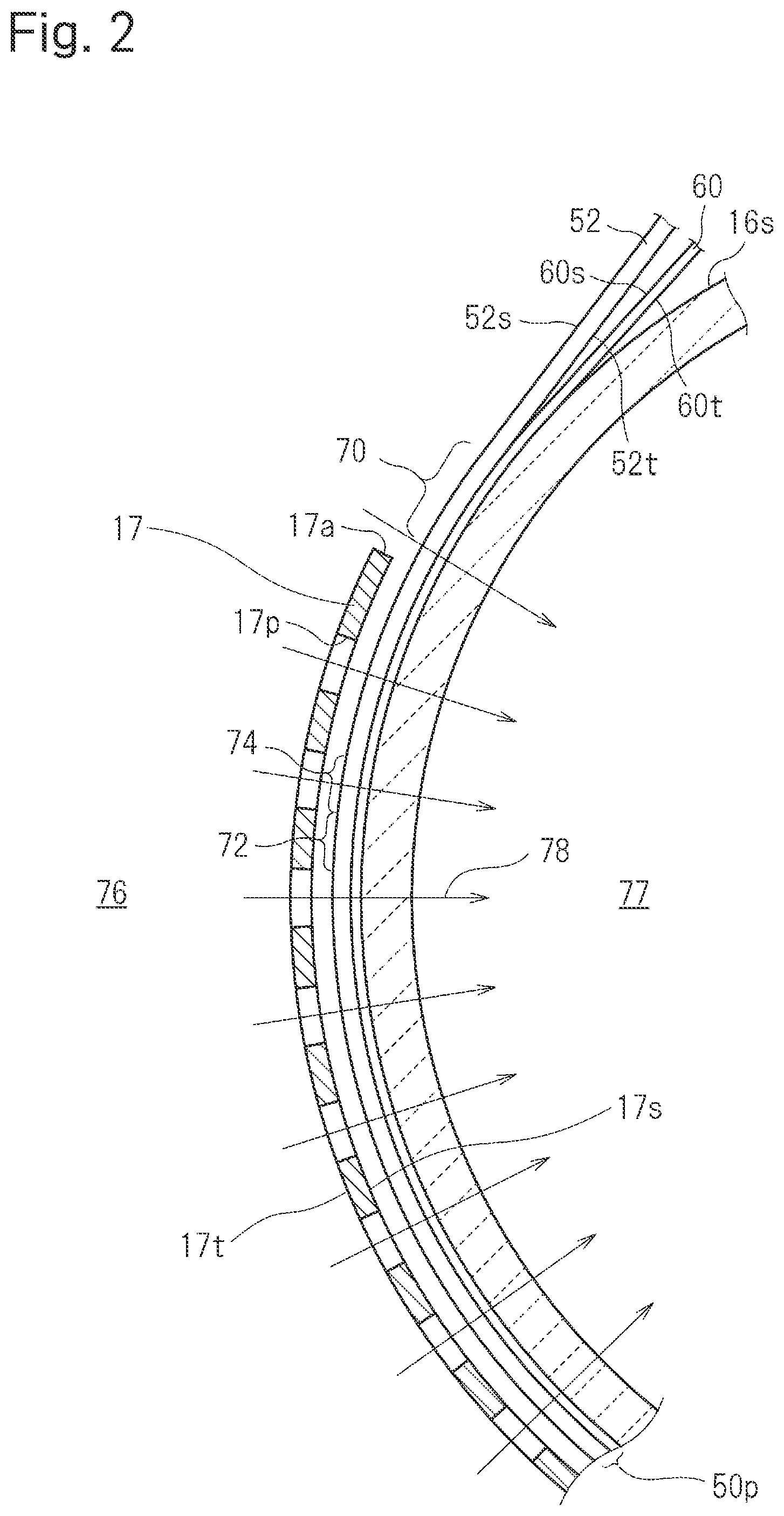 Patent US12097100 Figure 2 – Method for producing absorbent body