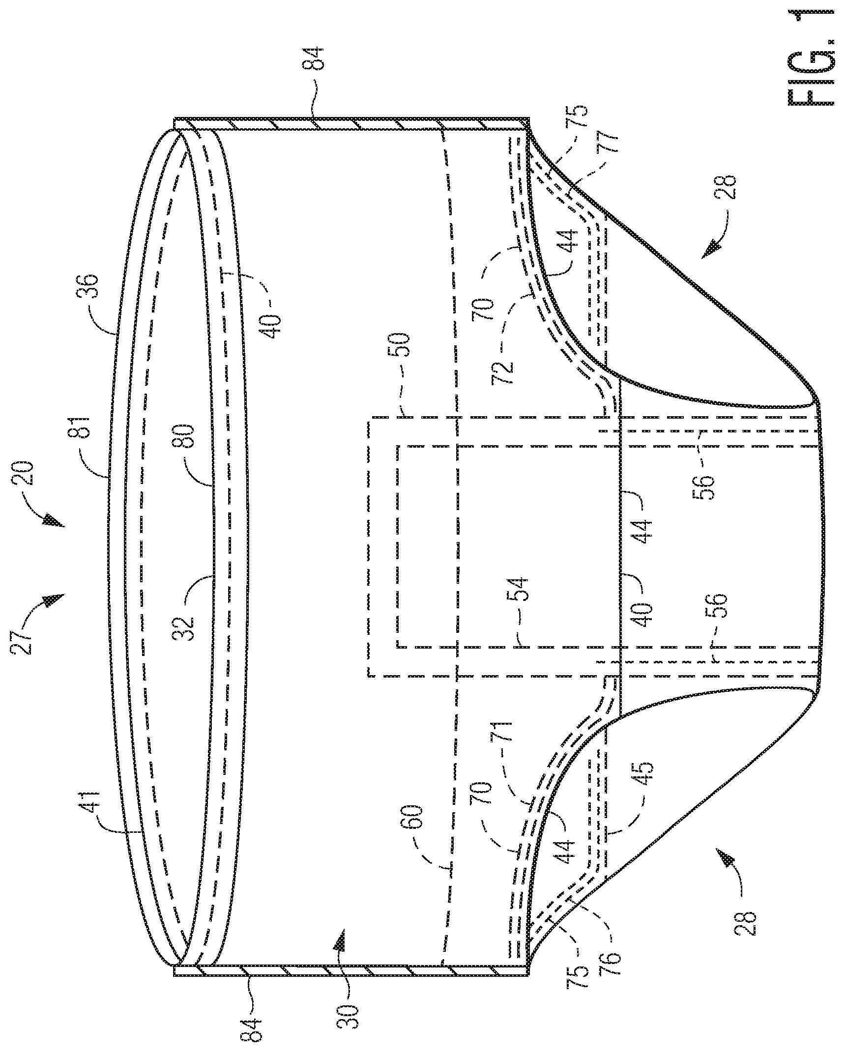 Patent US12097102 — Pant-like disposable absorbent articles with improved chassis construction — Figure 1