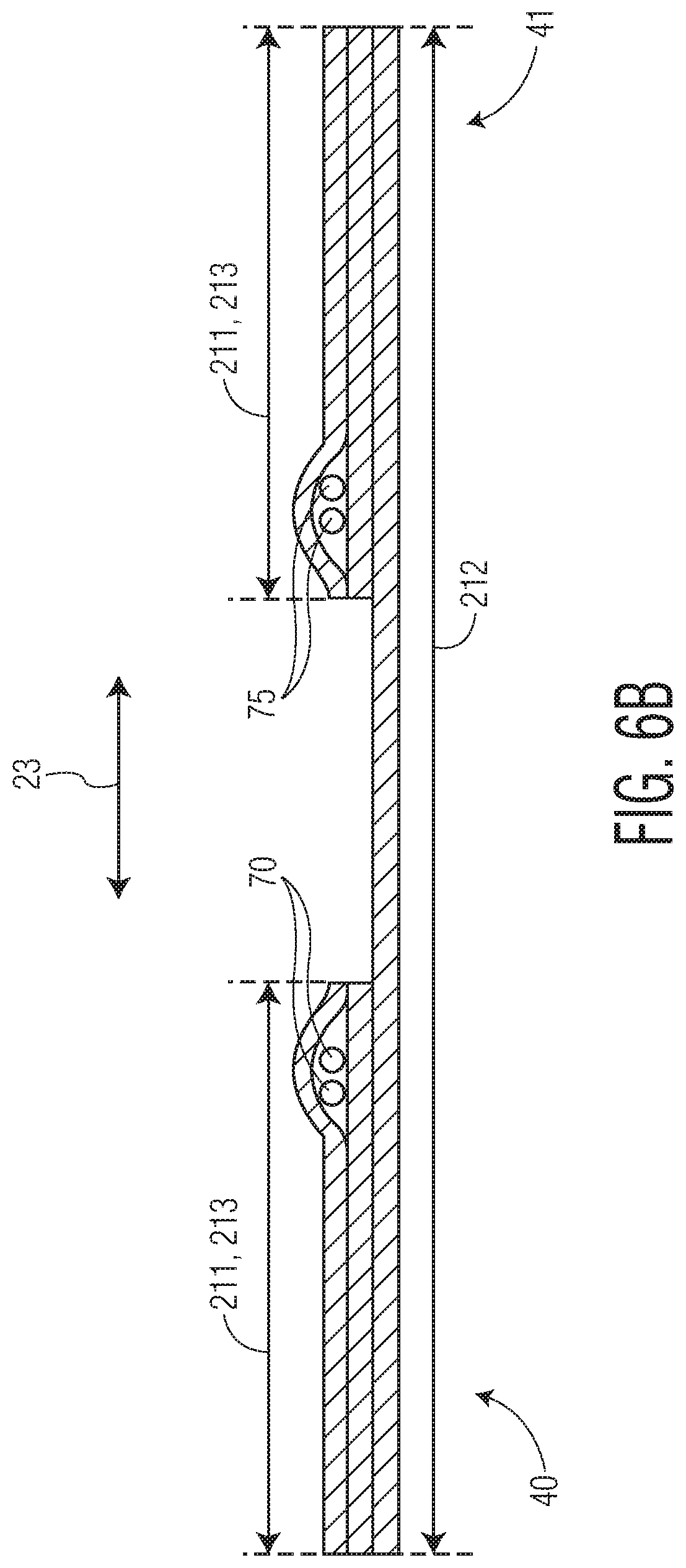 Patent US12097102 Figure 10 – Pant-like disposable absorbent articles with improved chassis construction