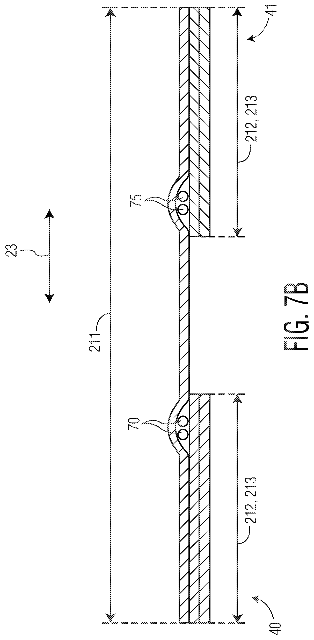 Patent US12097102 Figure 12 – Pant-like disposable absorbent articles with improved chassis construction