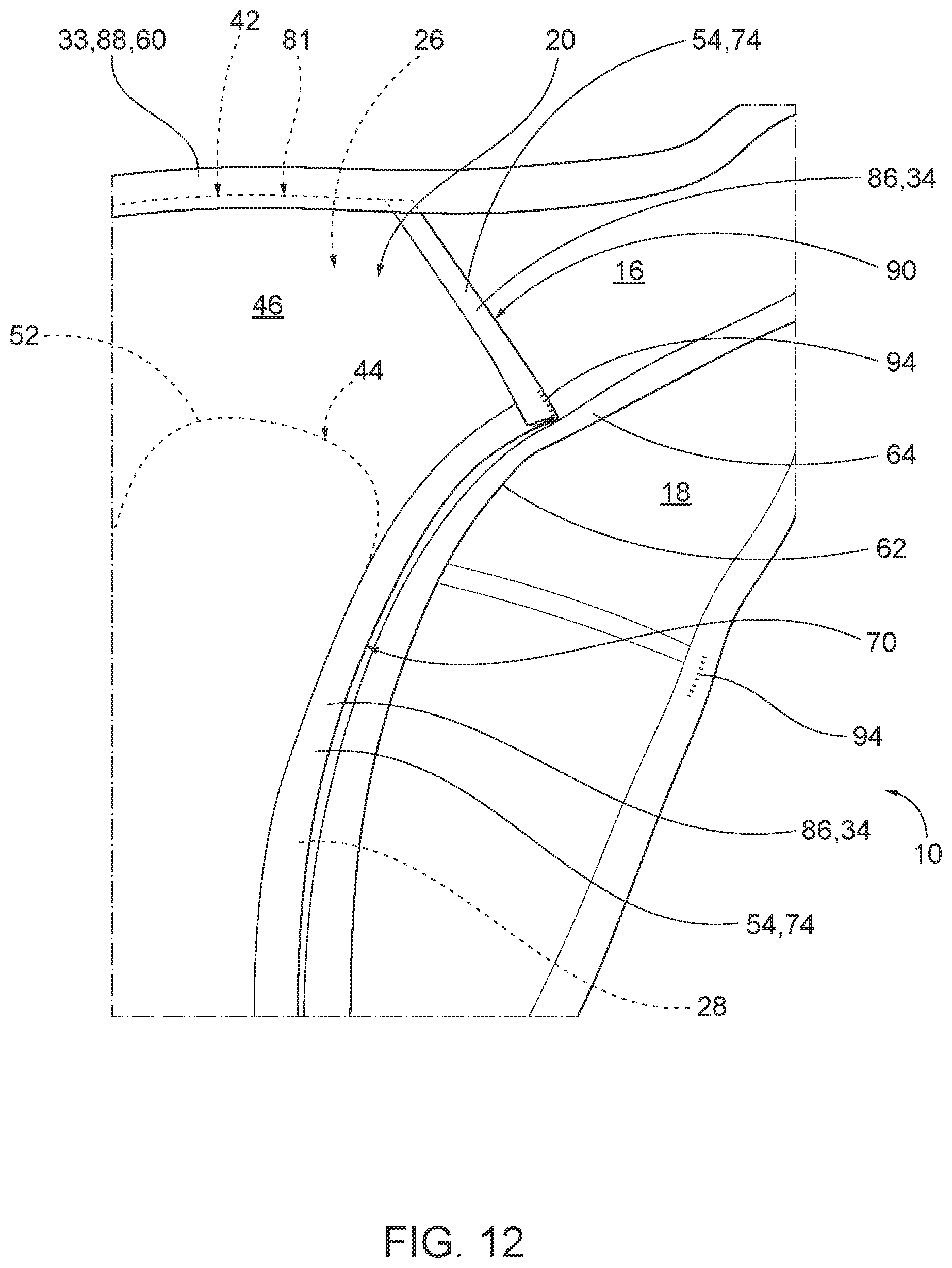Patent US12097103 Figure 11 – Garments with fluid retention assemblies and related methods