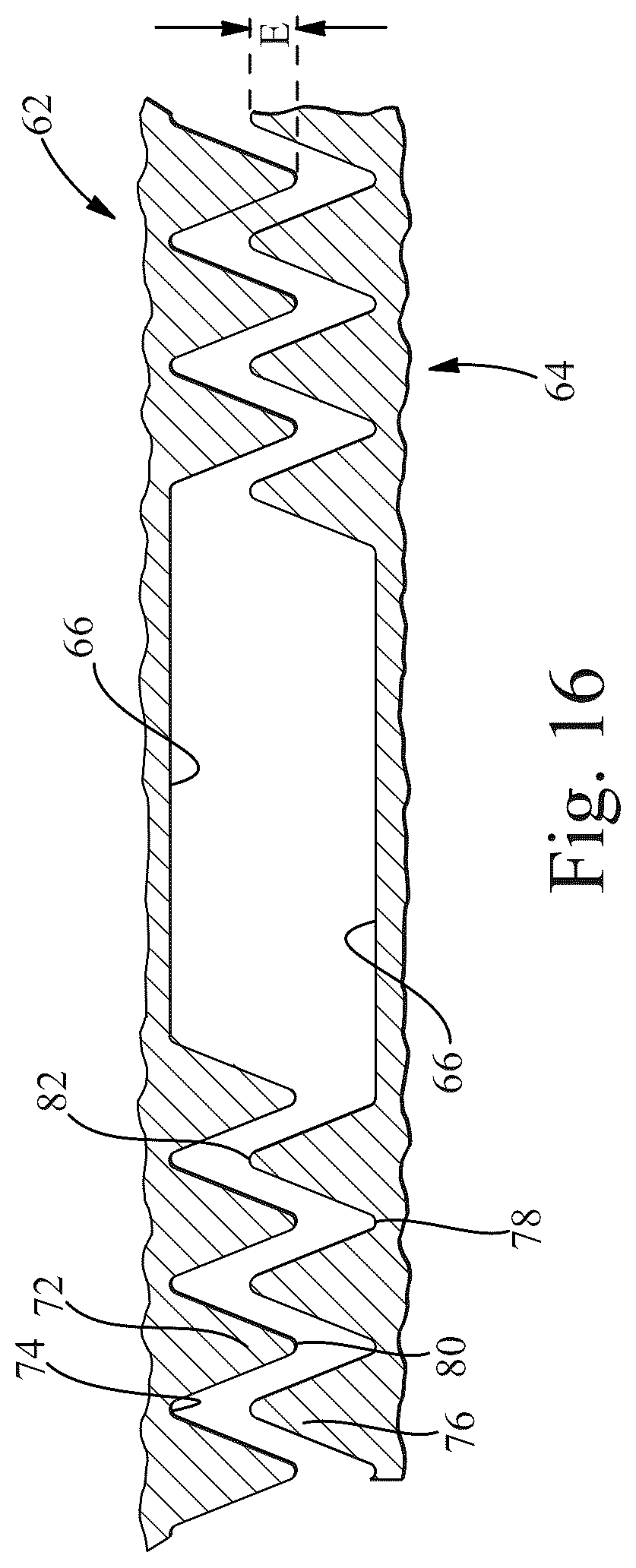 Patent US12097104 Figure 13 – Methods of making laminates for absorbent articles