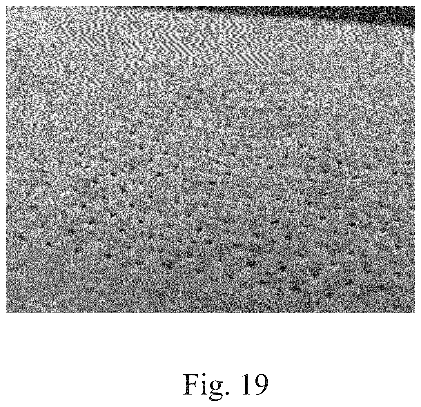 Patent US12097104 Figure 16 – Methods of making laminates for absorbent articles