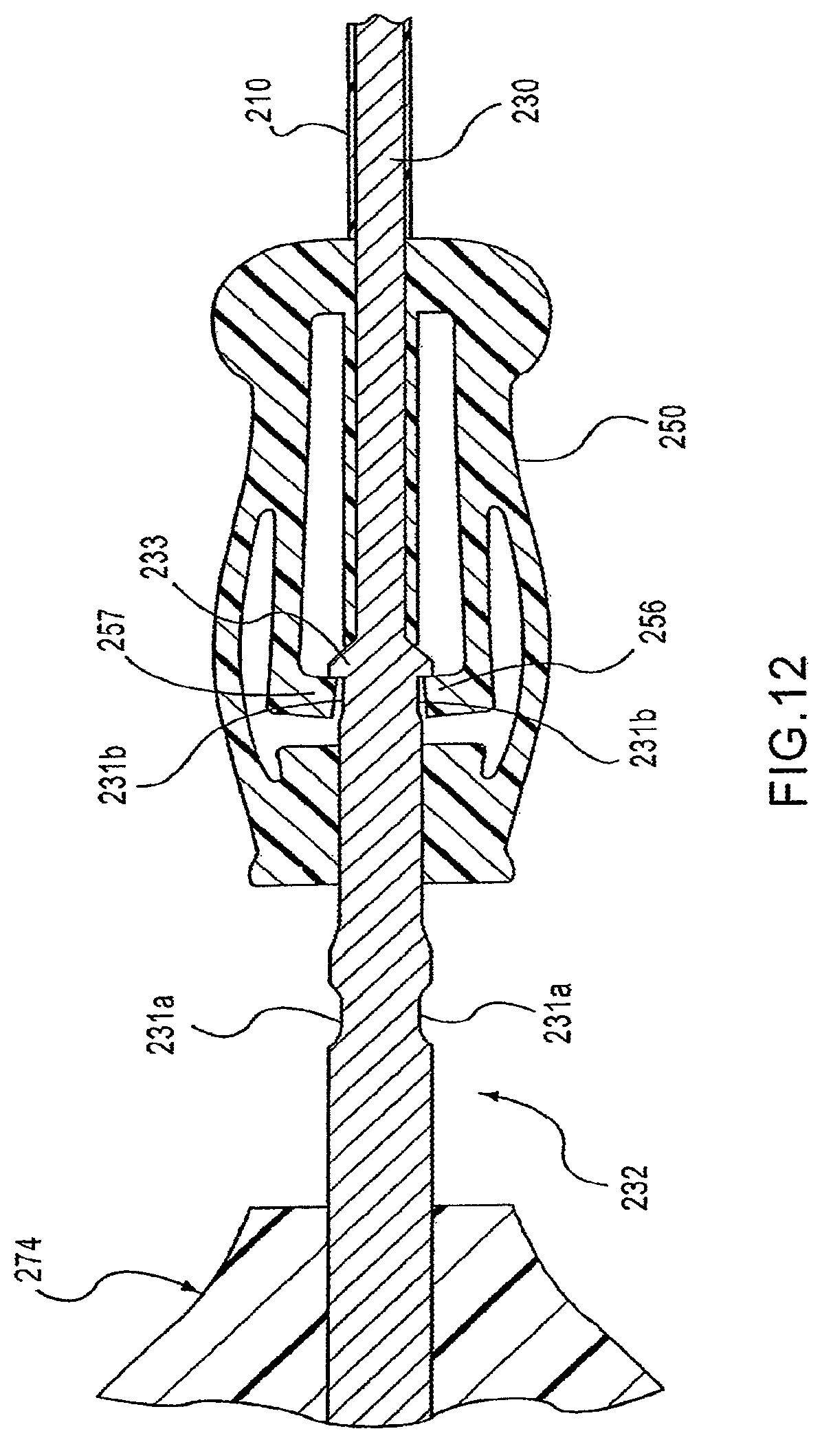 Patent US12097106 Figure 13 – Insertion device for delivery of a mesh carrier