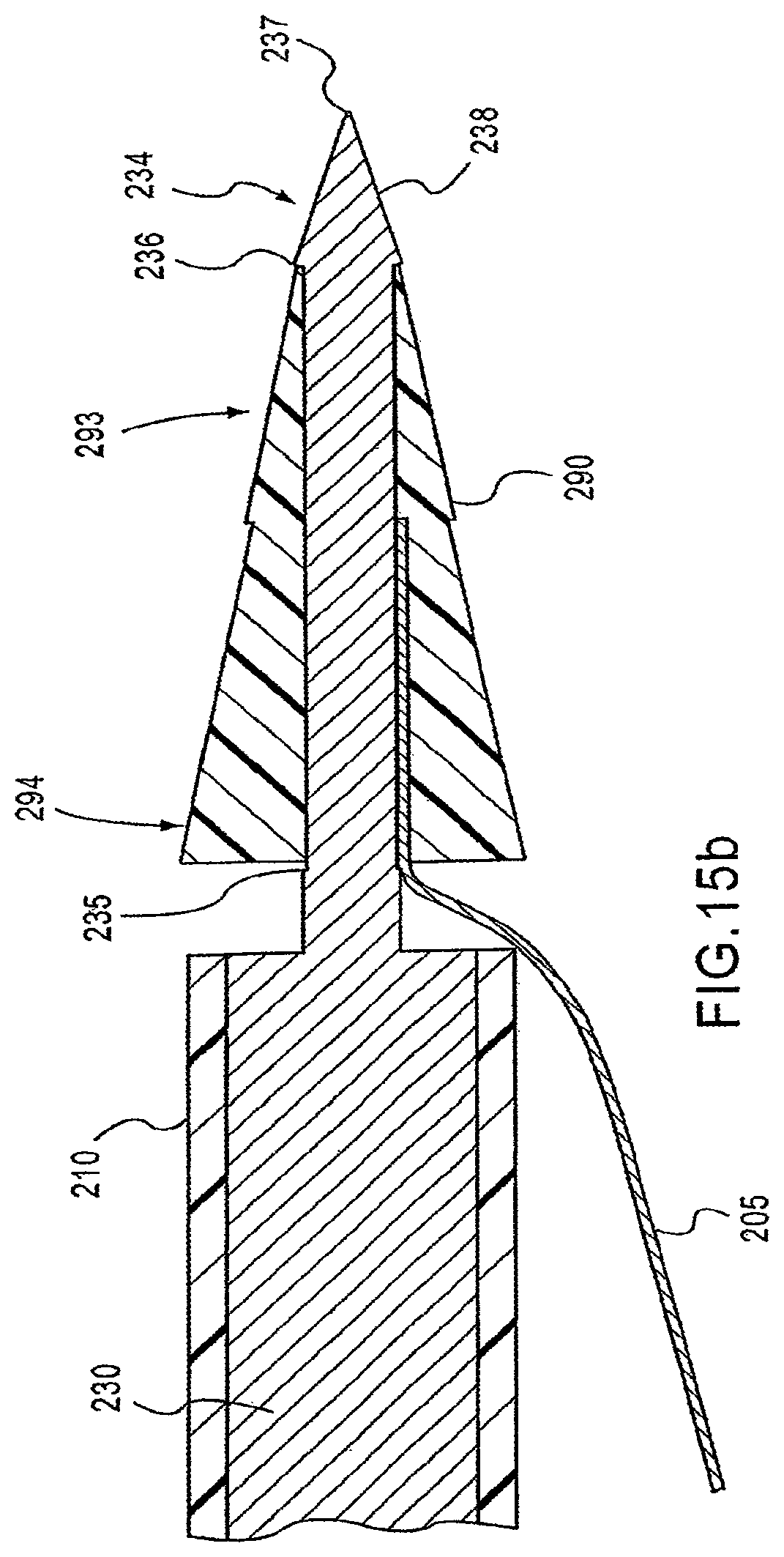 Patent US12097106 Figure 17 – Insertion device for delivery of a mesh carrier