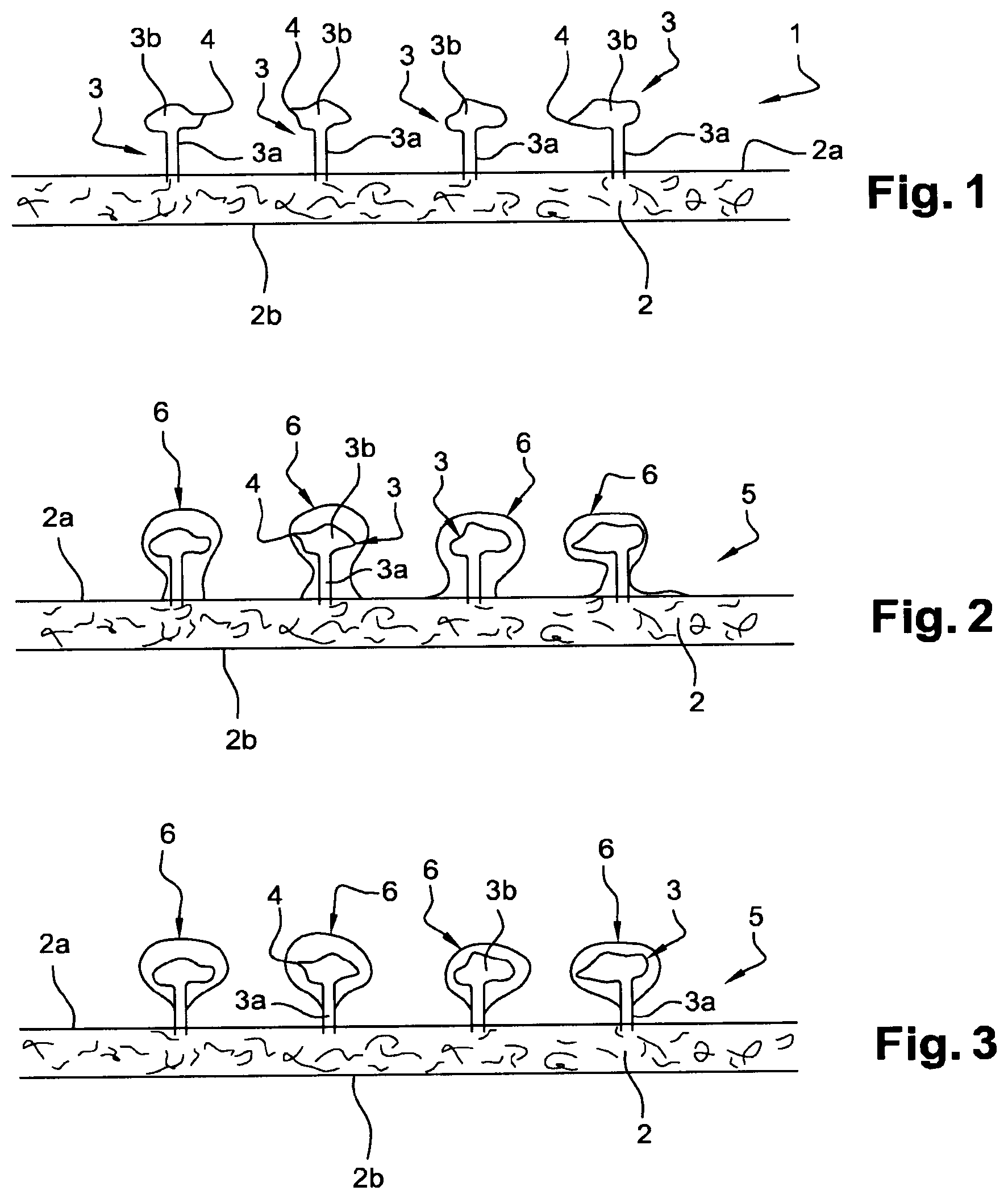 Patent US12097107 Figure 1 – Fabric with barbs coated with a water-soluble material