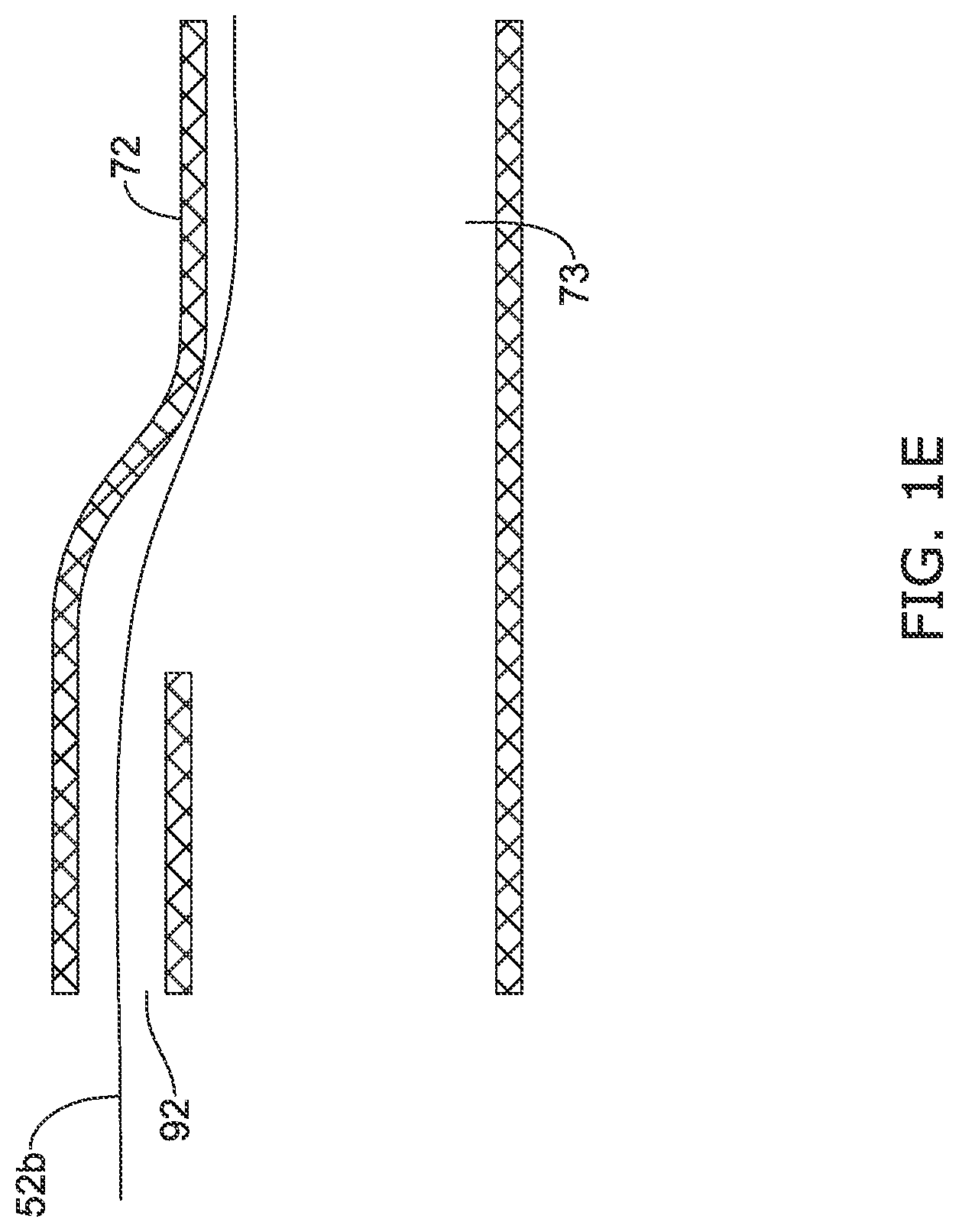 Patent US12097108 Figure 5 – Systems and methods for protecting the cerebral vasculature