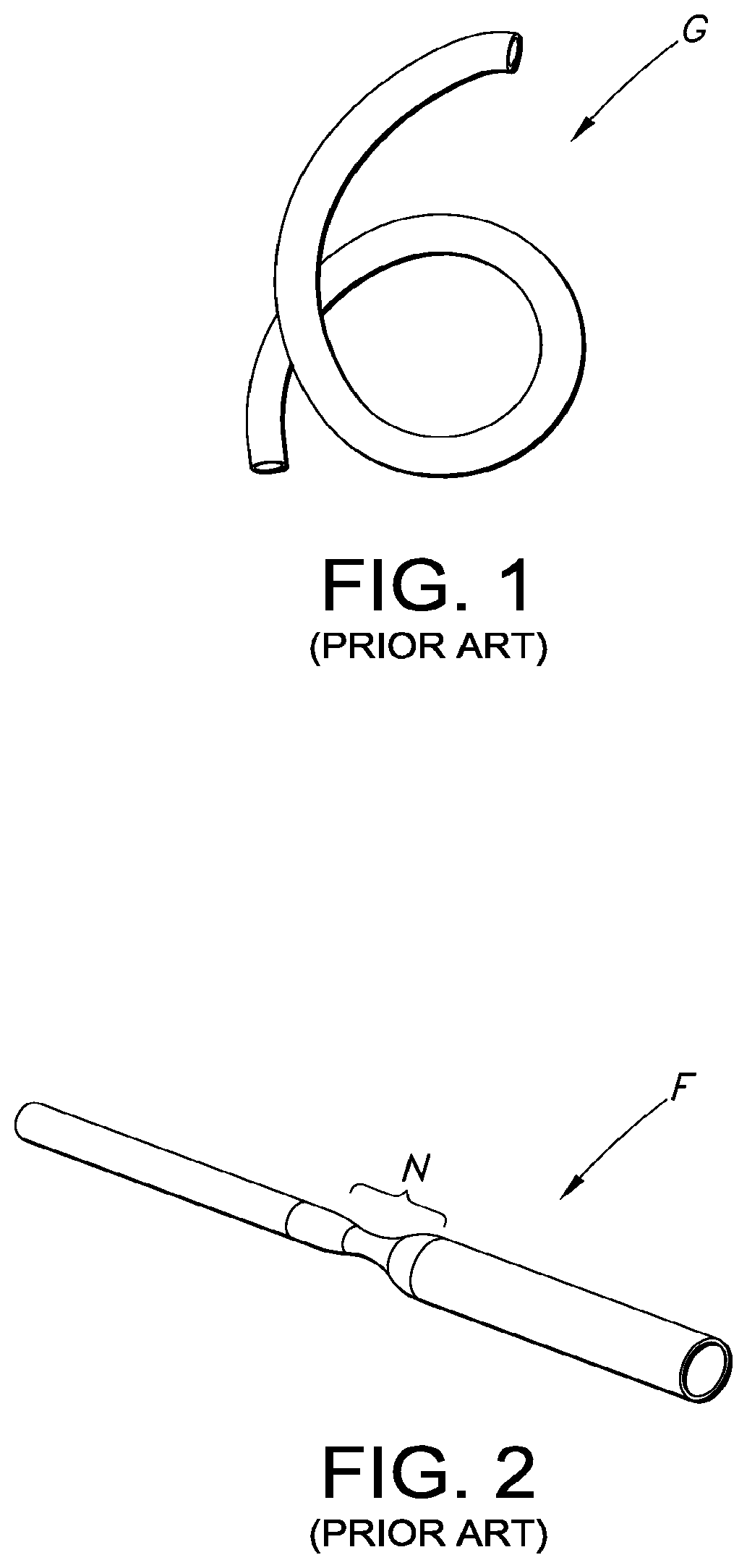 Patent US12097109 Figure 1 – Adjustable vascular graft for custom inner diameter reduction and related methods