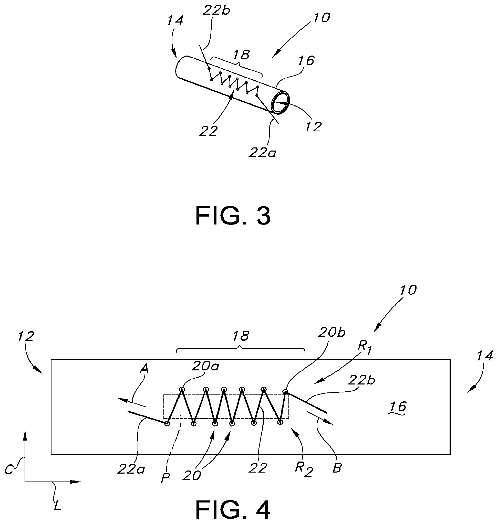 Patent US12097109 Figure 2 – Adjustable vascular graft for custom inner diameter reduction and related methods