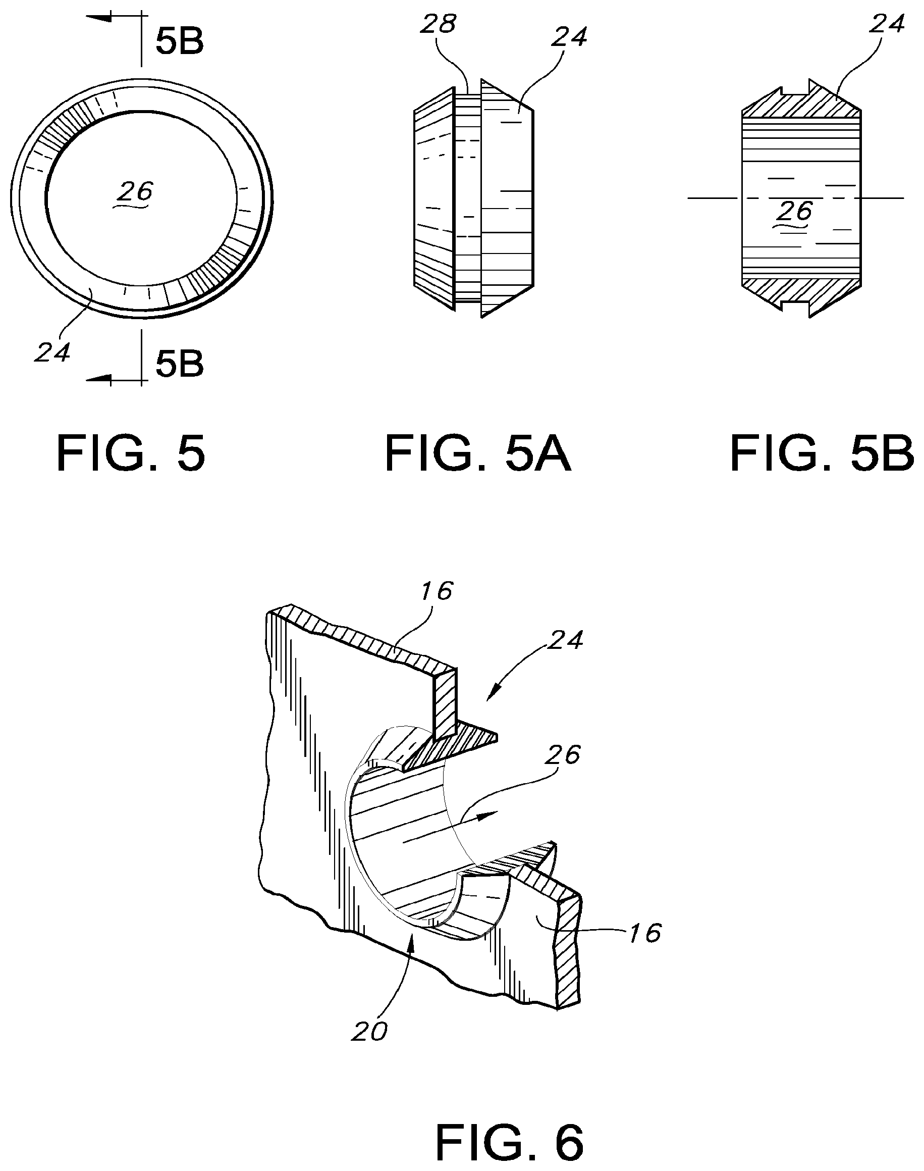 Patent US12097109 Figure 3 – Adjustable vascular graft for custom inner diameter reduction and related methods