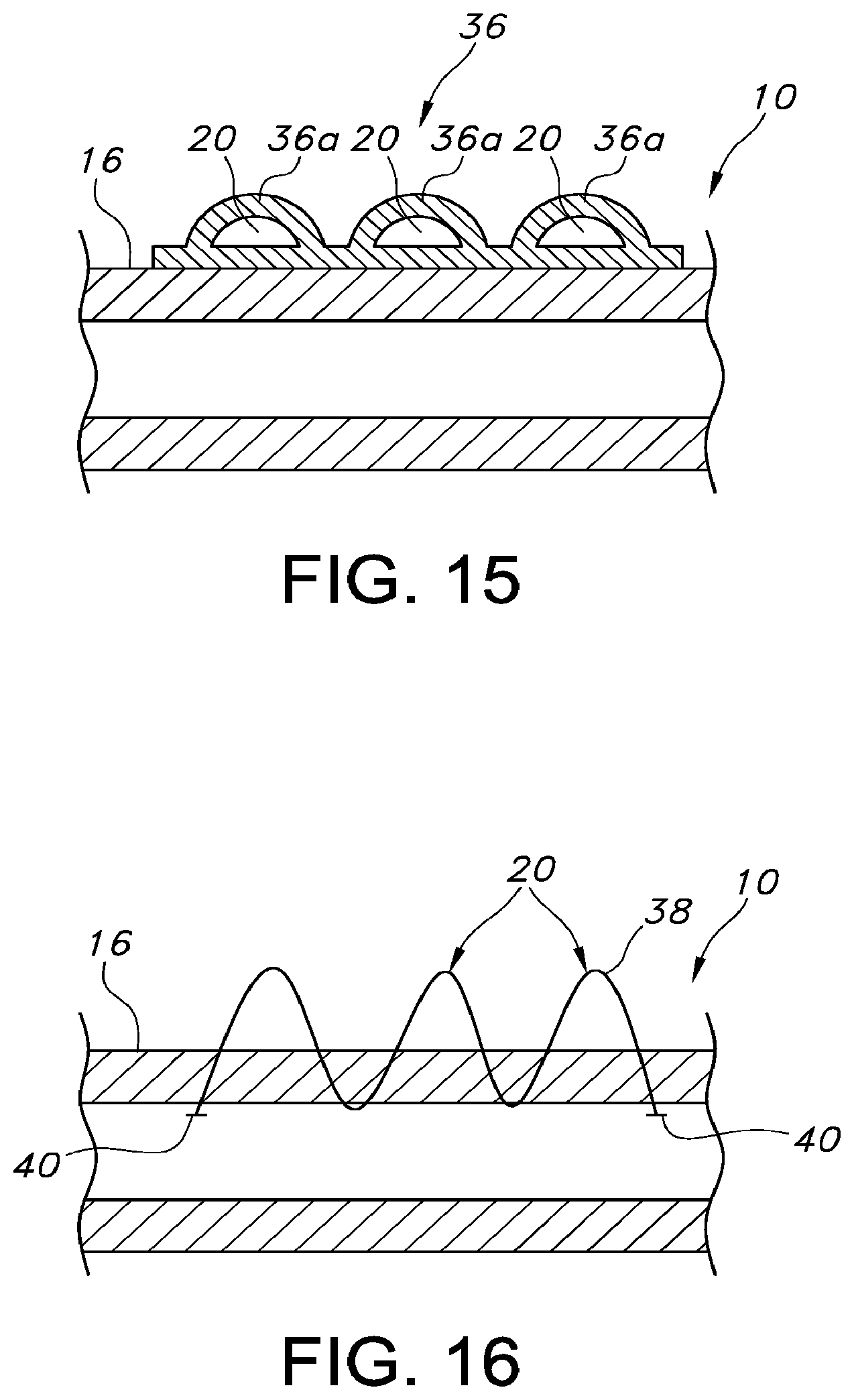 Patent US12097109 Figure 7 – Adjustable vascular graft for custom inner diameter reduction and related methods