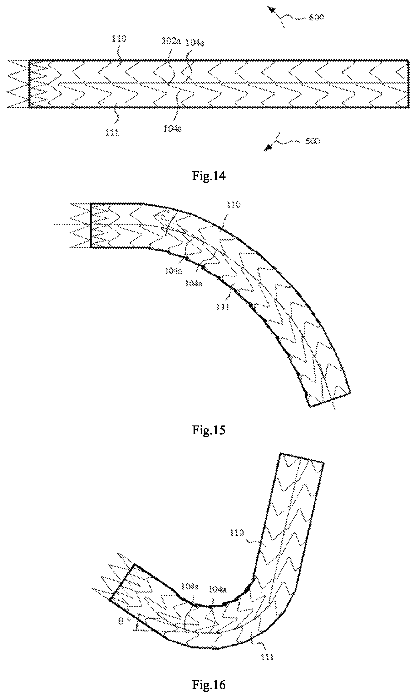 Patent US12097110 Figure 5 – Covered stent