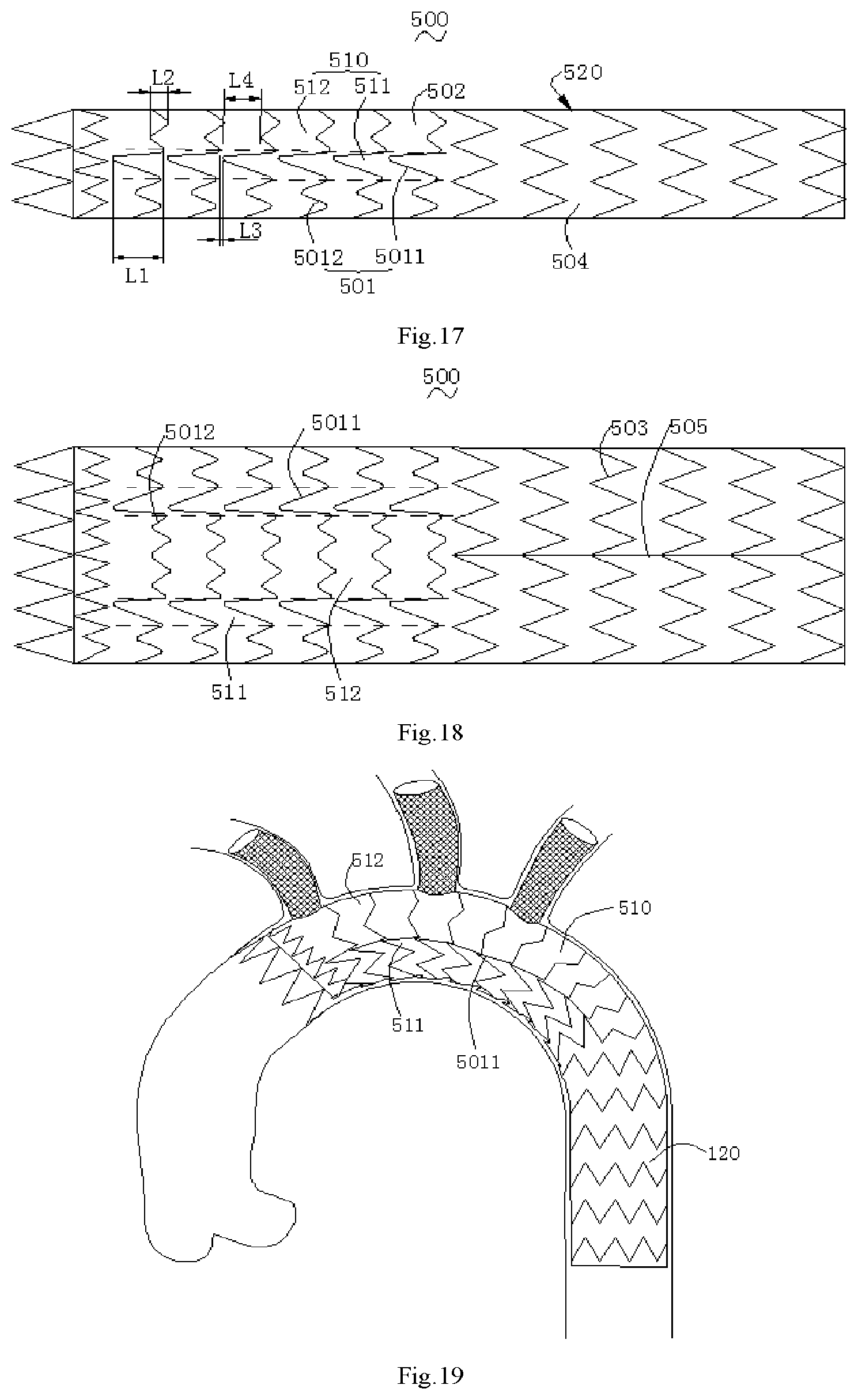Patent US12097110 Figure 6 – Covered stent