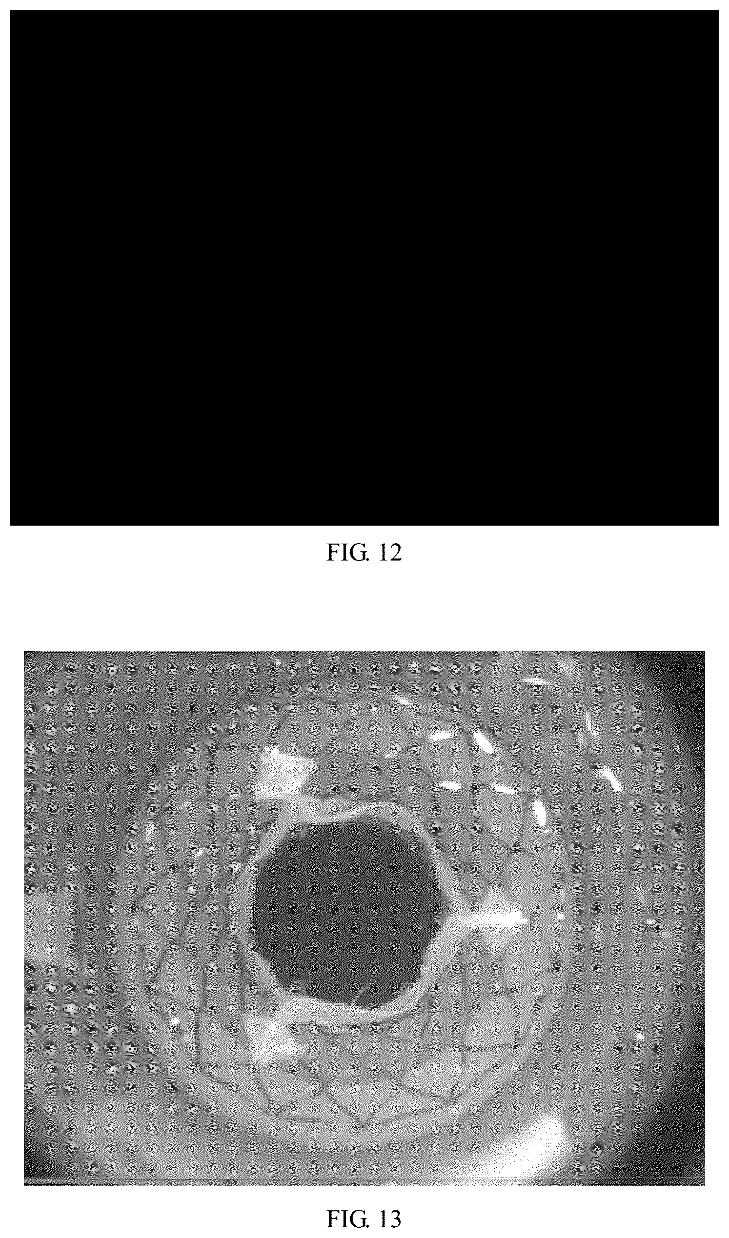 Patent US12097113 Figure 7 – Bioprosthetic valve and preparation method thereof