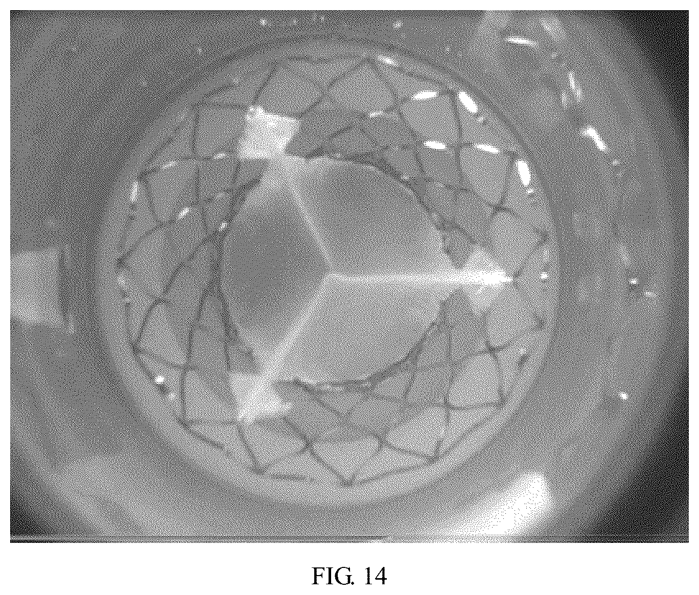 Patent US12097113 Figure 8 – Bioprosthetic valve and preparation method thereof