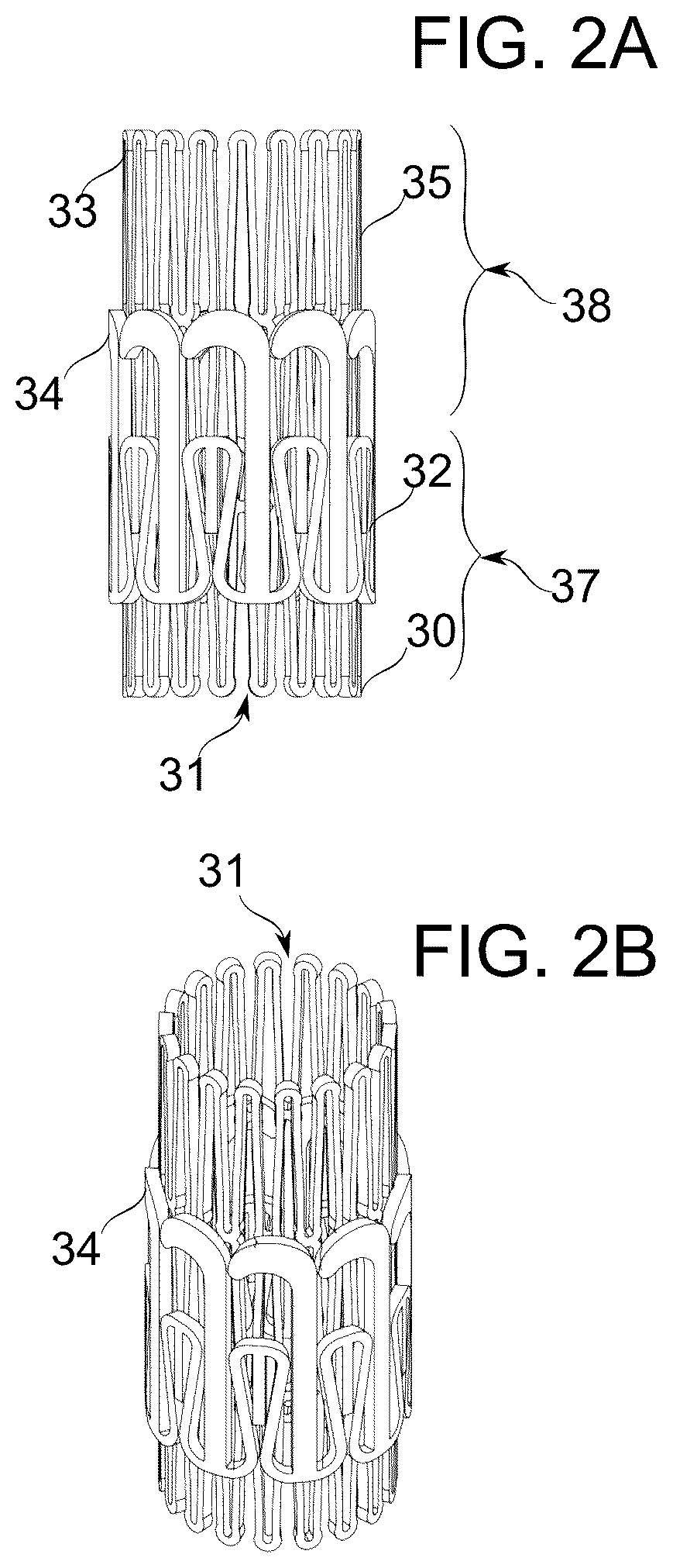 Patent US12097114 Figure 2 – Ventricular structure reshaping atrio-ventricular valve