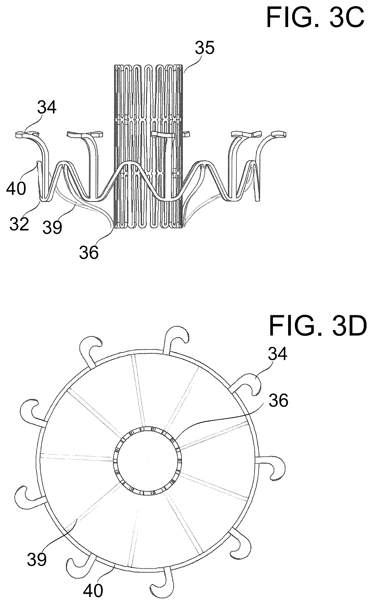 Patent US12097114 Figure 4 – Ventricular structure reshaping atrio-ventricular valve