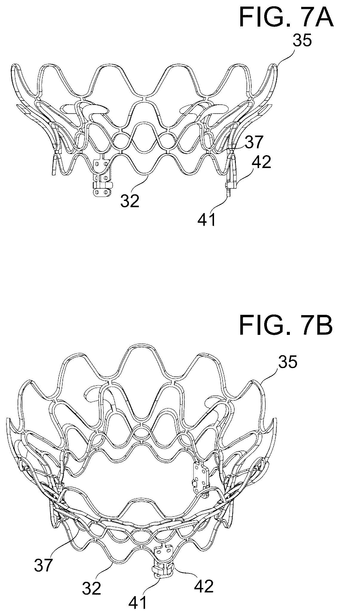 Patent US12097114 Figure 8 – Ventricular structure reshaping atrio-ventricular valve