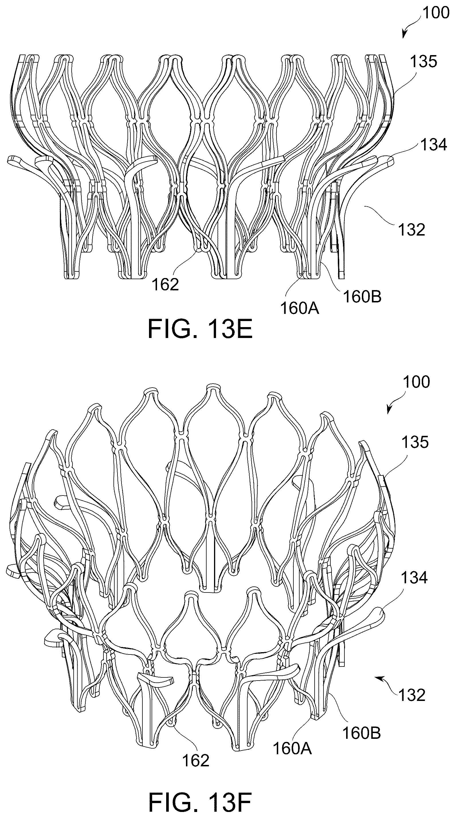 Patent US12097114 Figure 17 – Ventricular structure reshaping atrio-ventricular valve