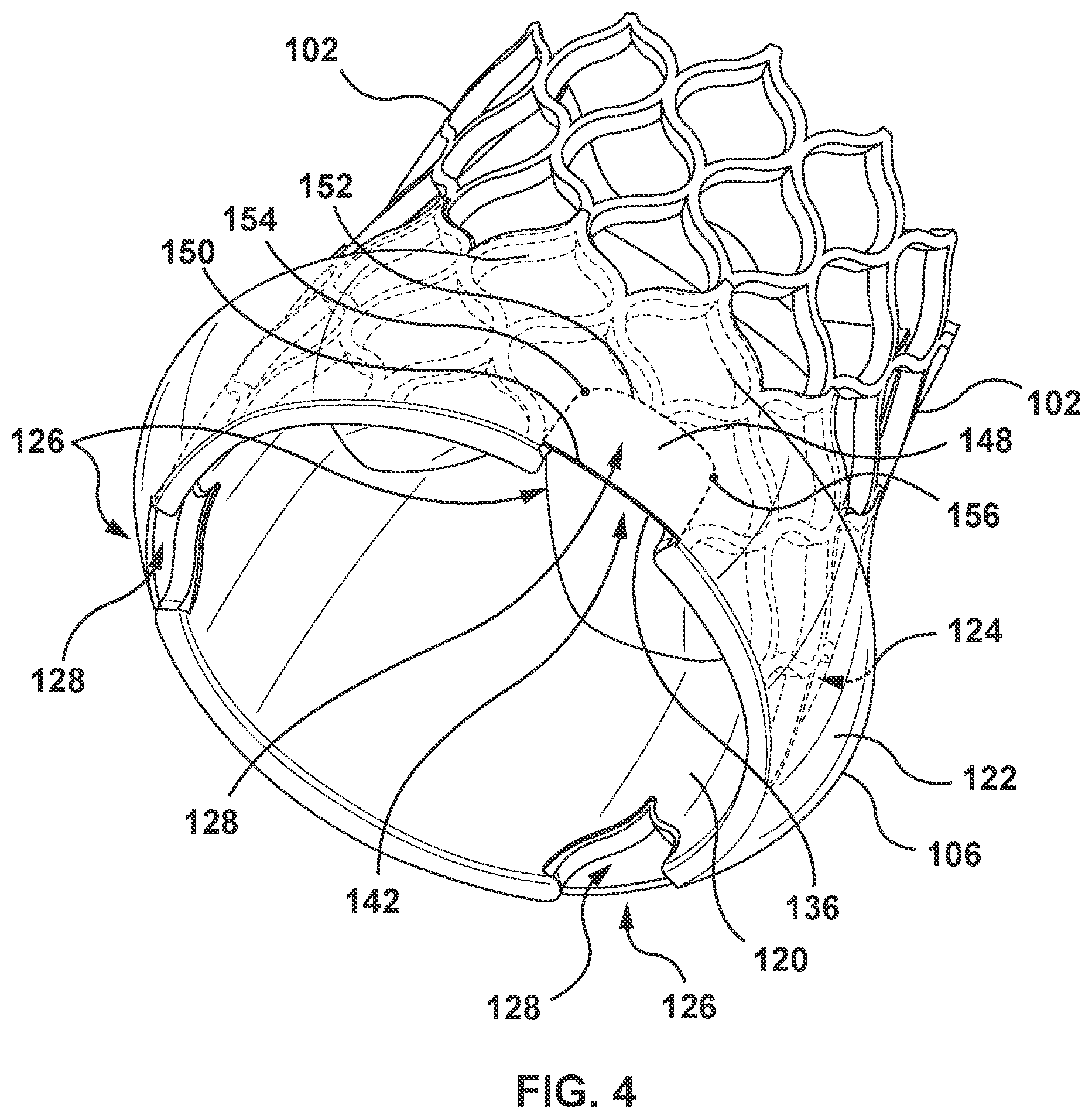 Patent US12097115 Figure 4 – Prosthesis with anti-paravalvular leakage component including a one-way valve