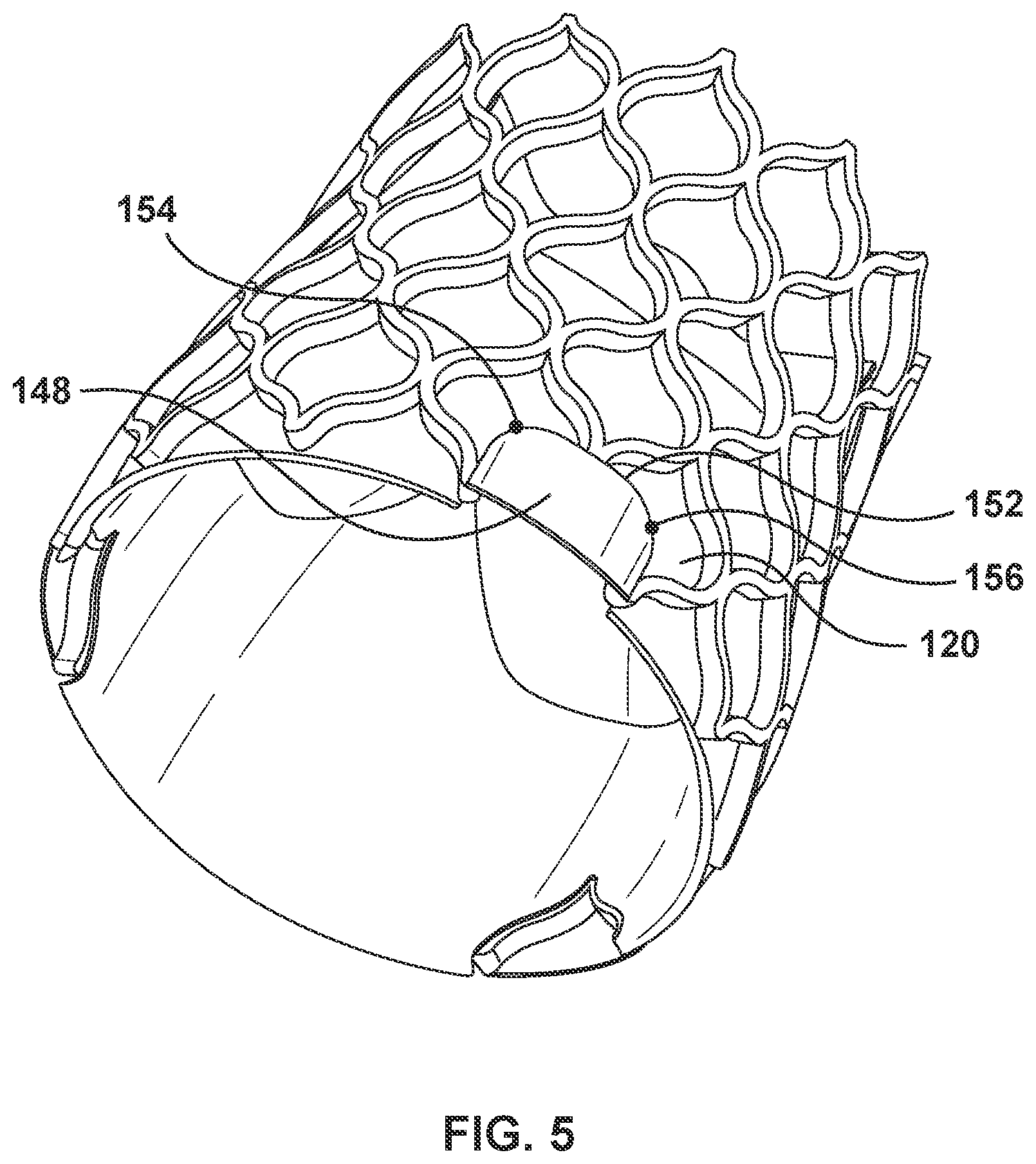 Patent US12097115 Figure 5 – Prosthesis with anti-paravalvular leakage component including a one-way valve