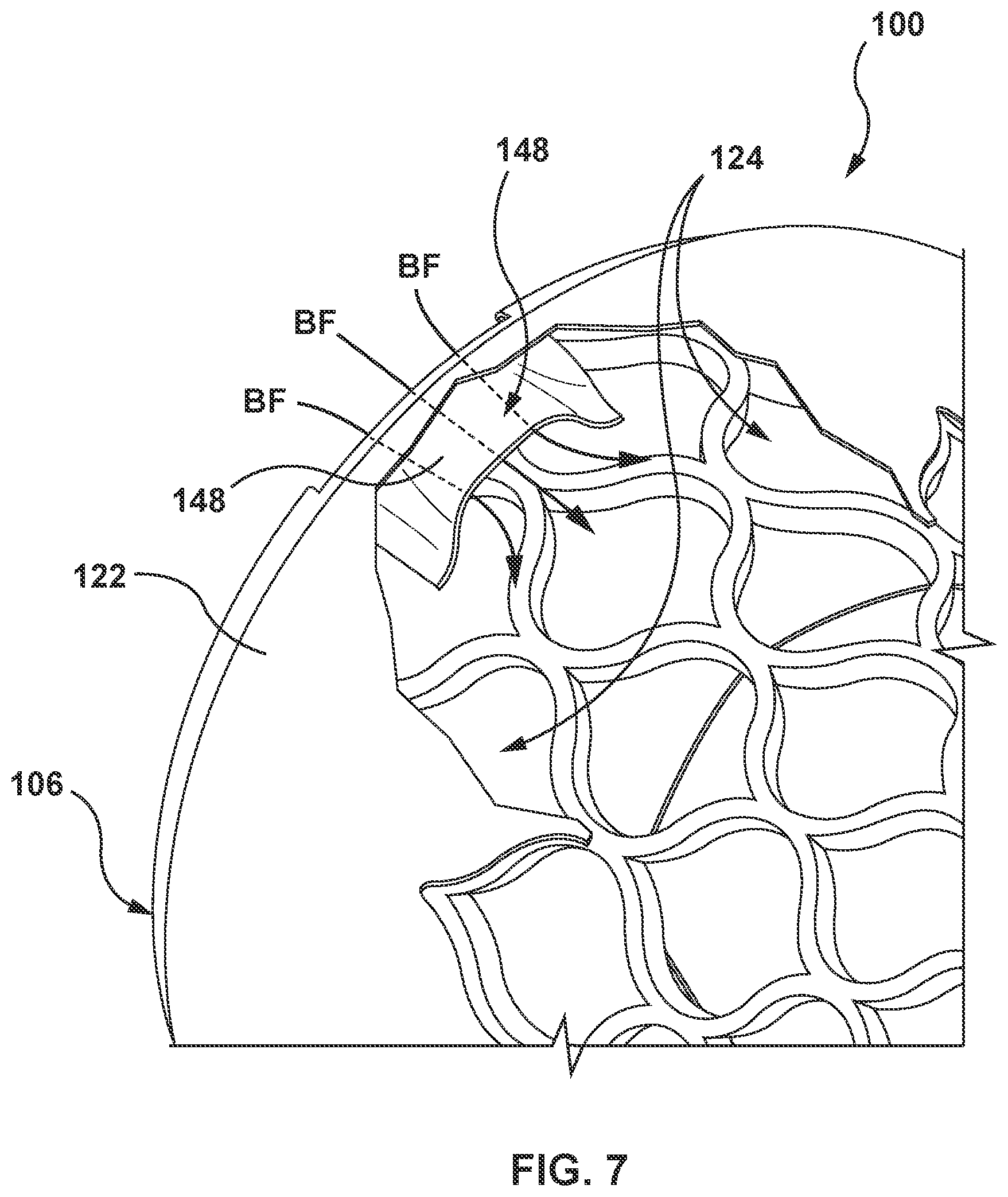 Patent US12097115 Figure 7 – Prosthesis with anti-paravalvular leakage component including a one-way valve