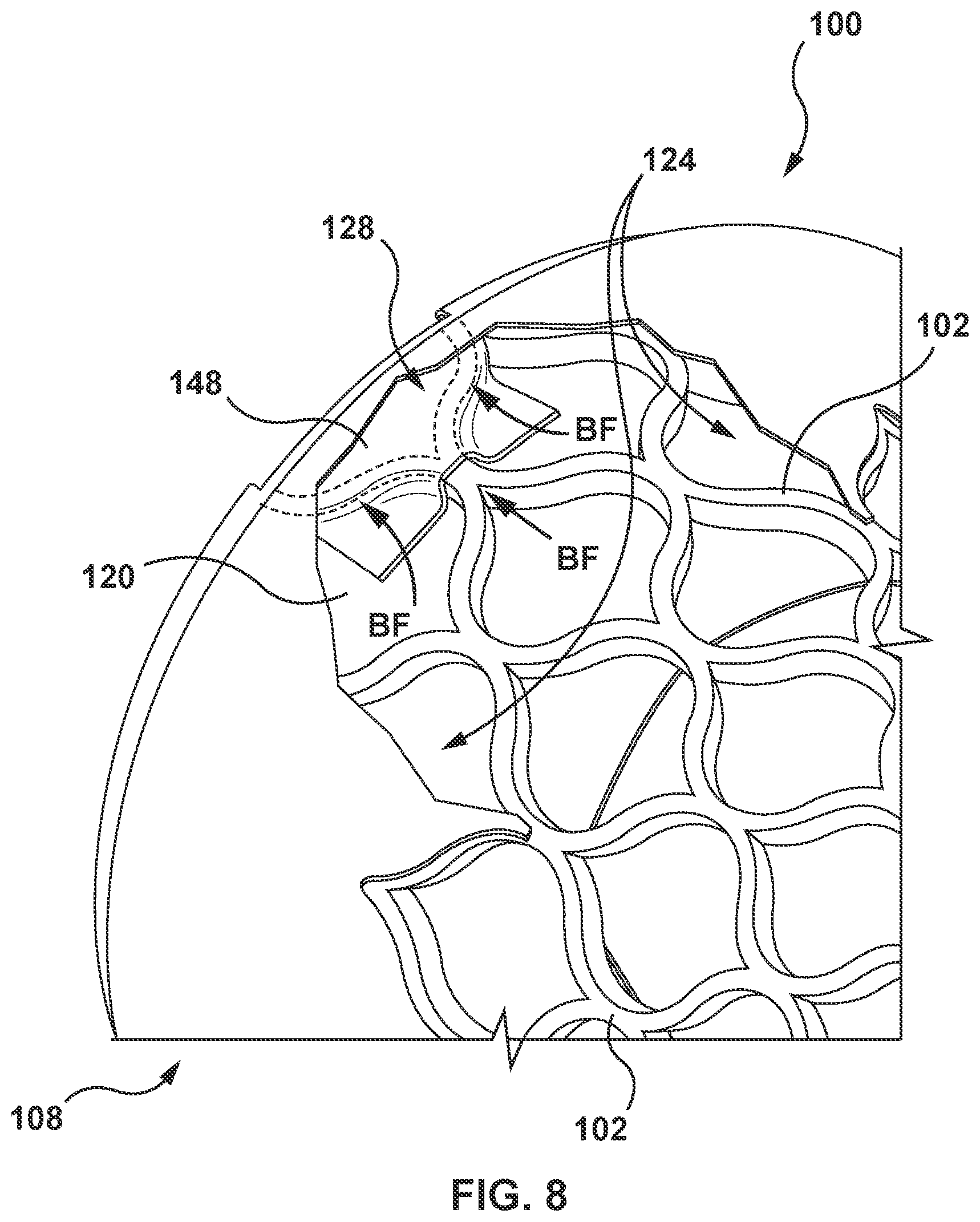 Patent US12097115 Figure 8 – Prosthesis with anti-paravalvular leakage component including a one-way valve