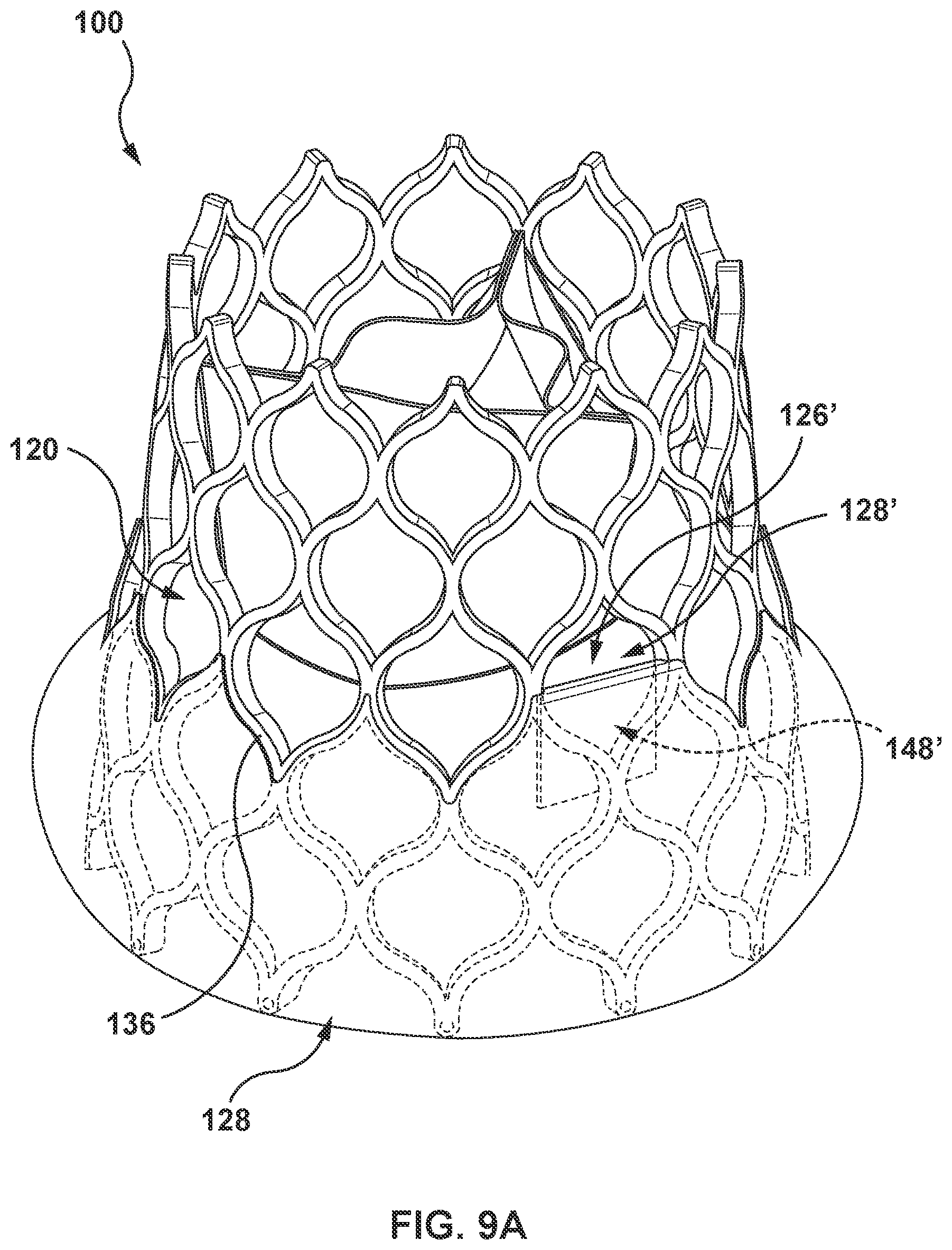 Patent US12097115 Figure 9 – Prosthesis with anti-paravalvular leakage component including a one-way valve