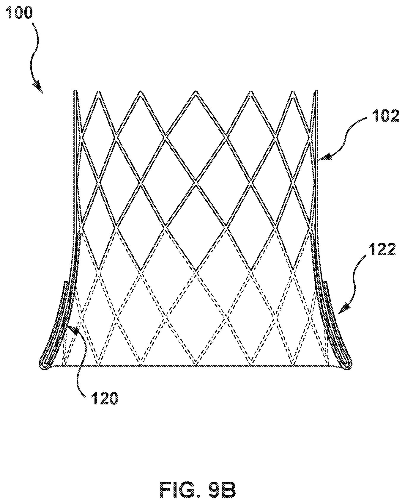 Patent US12097115 Figure 10 – Prosthesis with anti-paravalvular leakage component including a one-way valve
