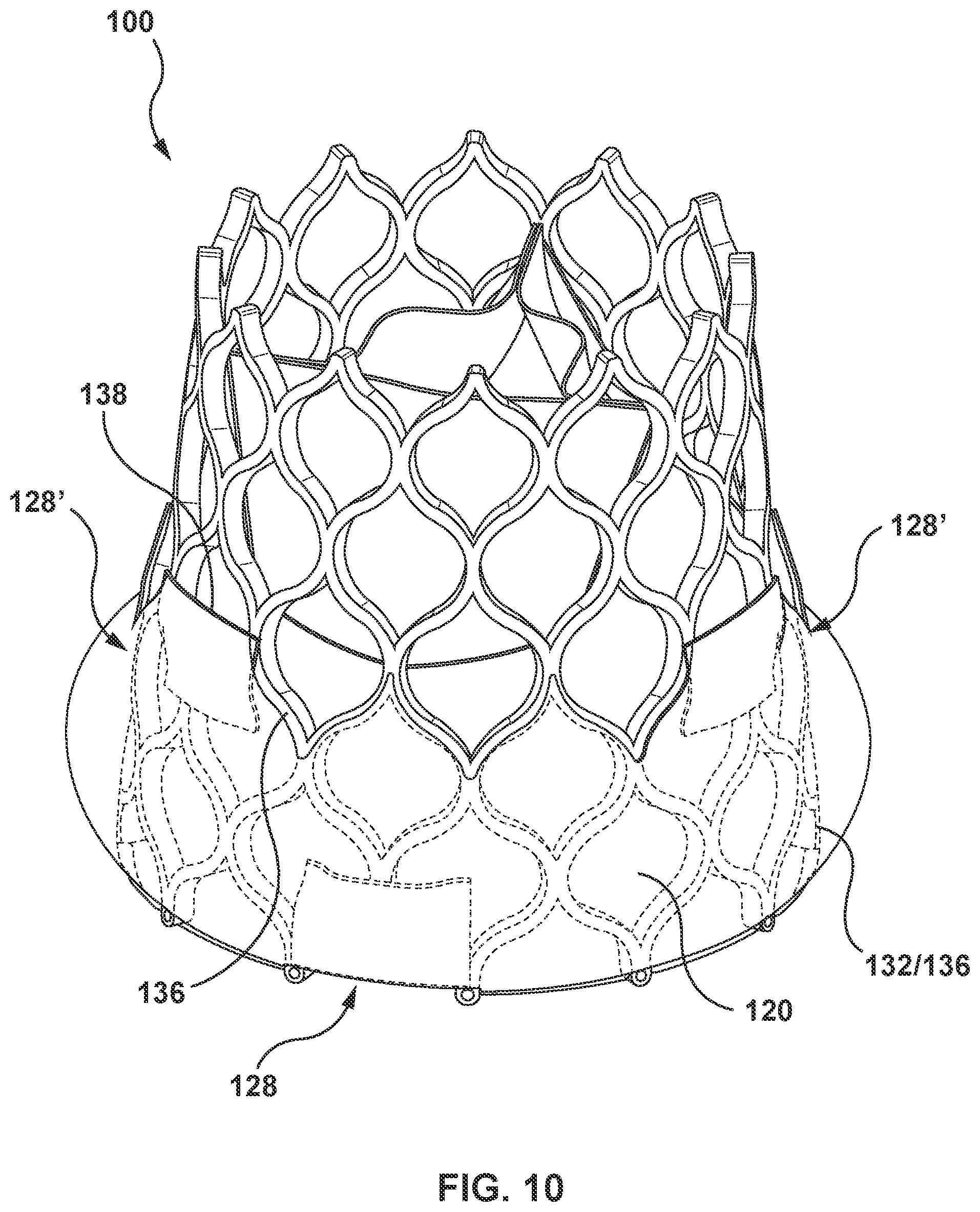 Patent US12097115 Figure 11 – Prosthesis with anti-paravalvular leakage component including a one-way valve
