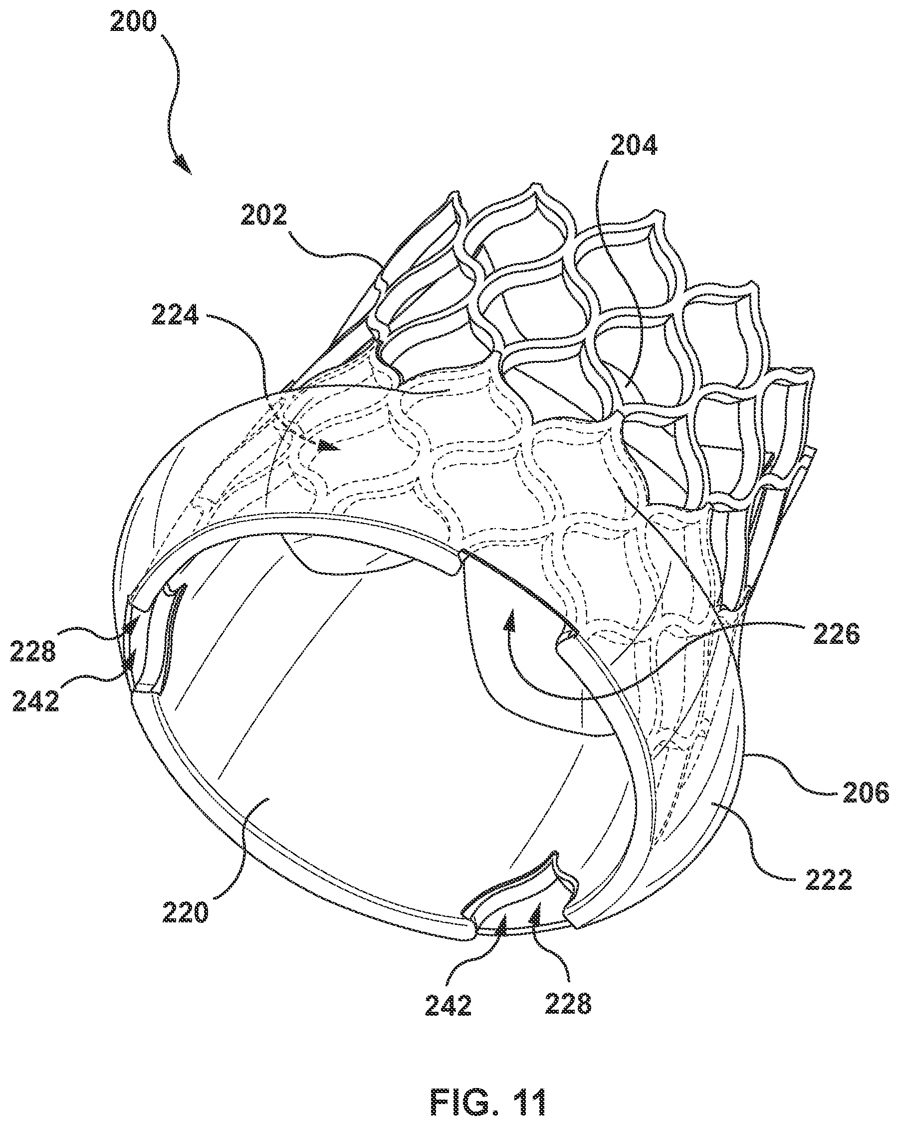 Patent US12097115 Figure 12 – Prosthesis with anti-paravalvular leakage component including a one-way valve