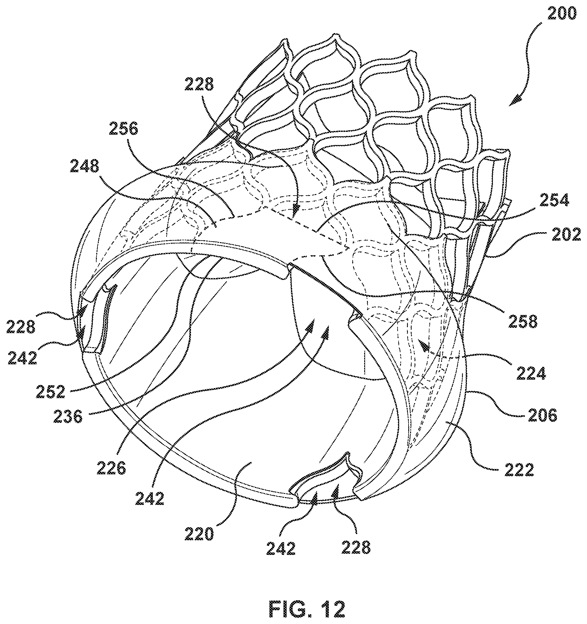 Patent US12097115 Figure 13 – Prosthesis with anti-paravalvular leakage component including a one-way valve