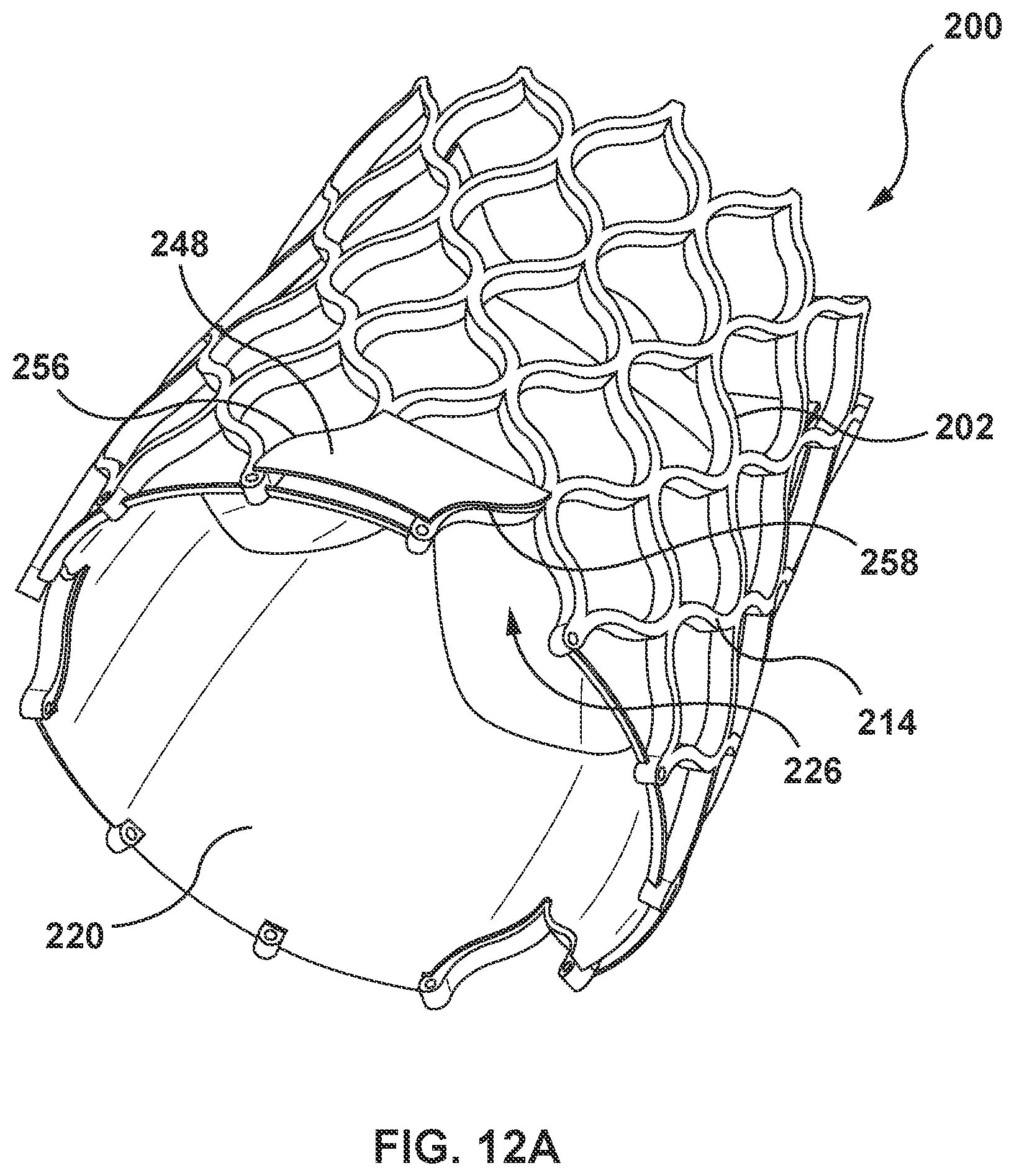 Patent US12097115 Figure 14 – Prosthesis with anti-paravalvular leakage component including a one-way valve