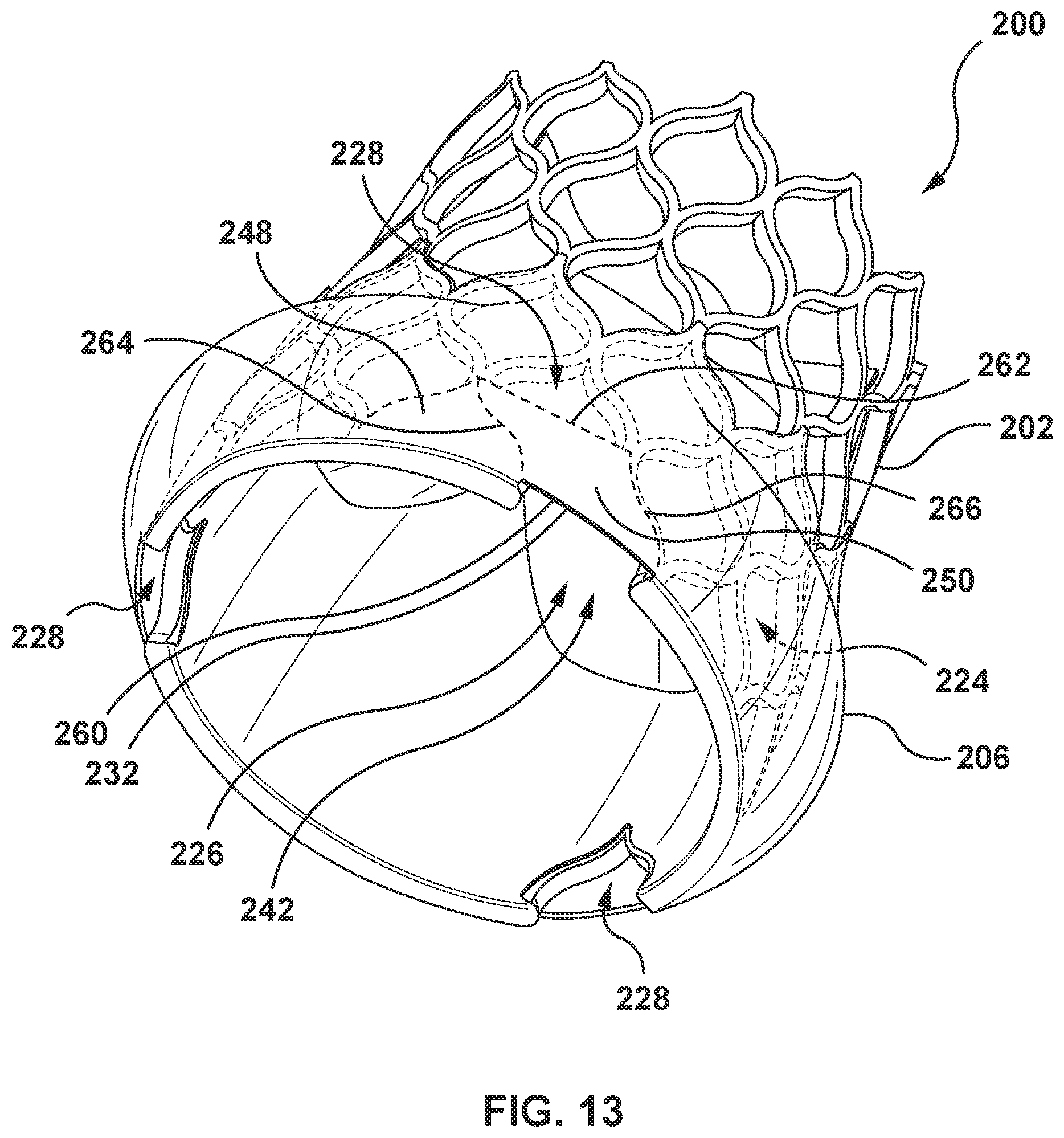 Patent US12097115 Figure 15 – Prosthesis with anti-paravalvular leakage component including a one-way valve