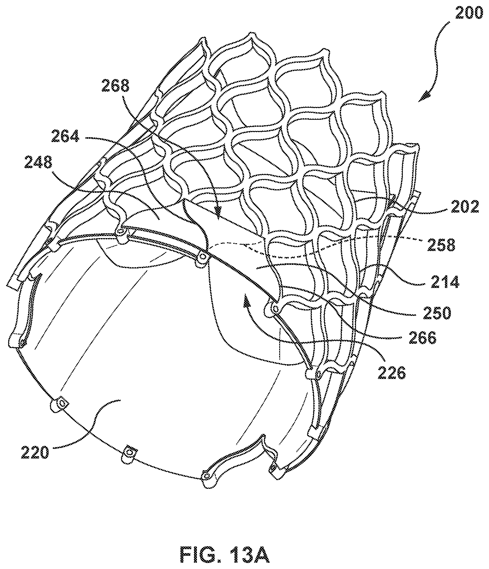 Patent US12097115 Figure 16 – Prosthesis with anti-paravalvular leakage component including a one-way valve