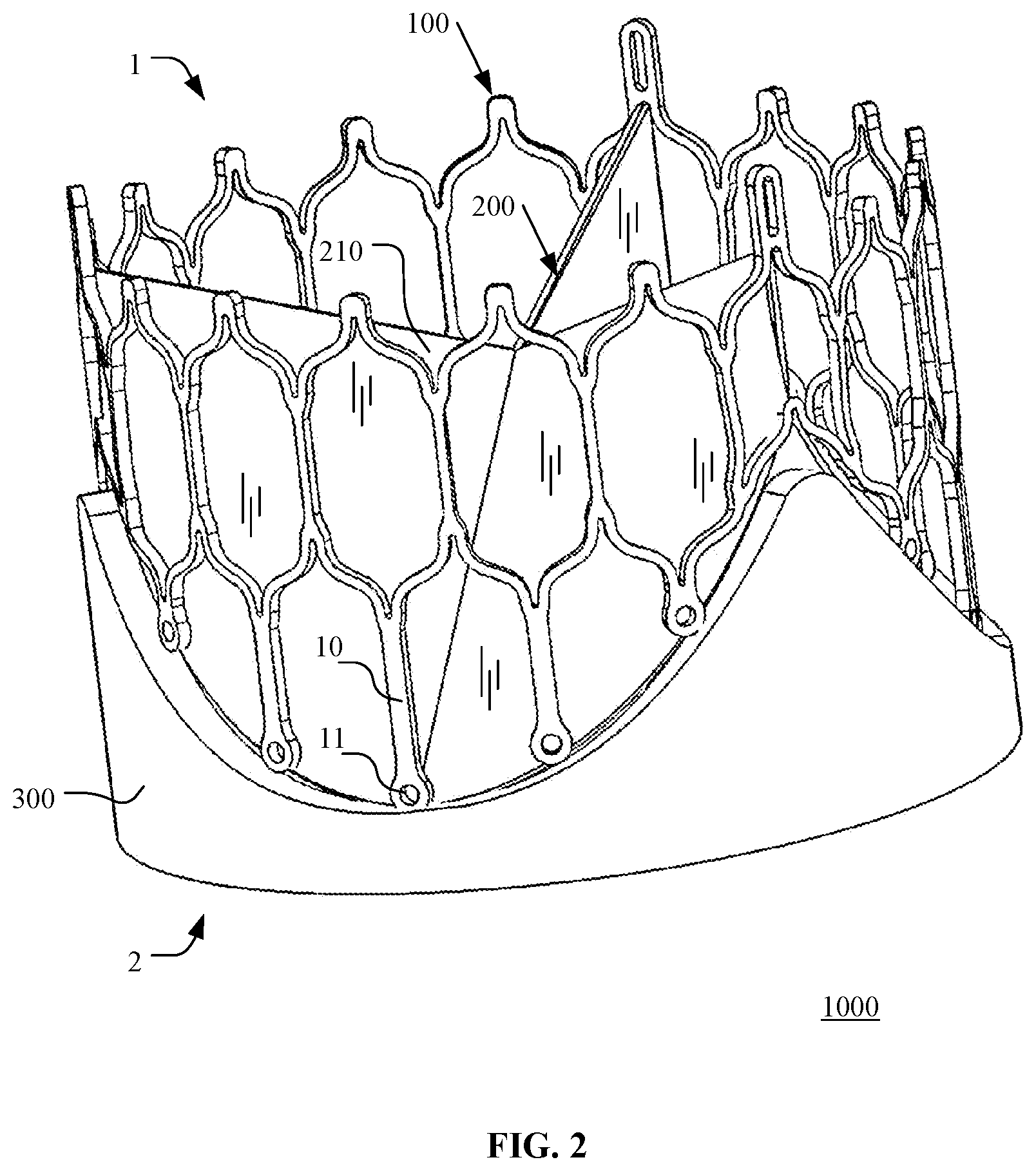 Patent US12097116 Figure 2 – Prosthetic heart valve for multiple positions and assembling method thereof