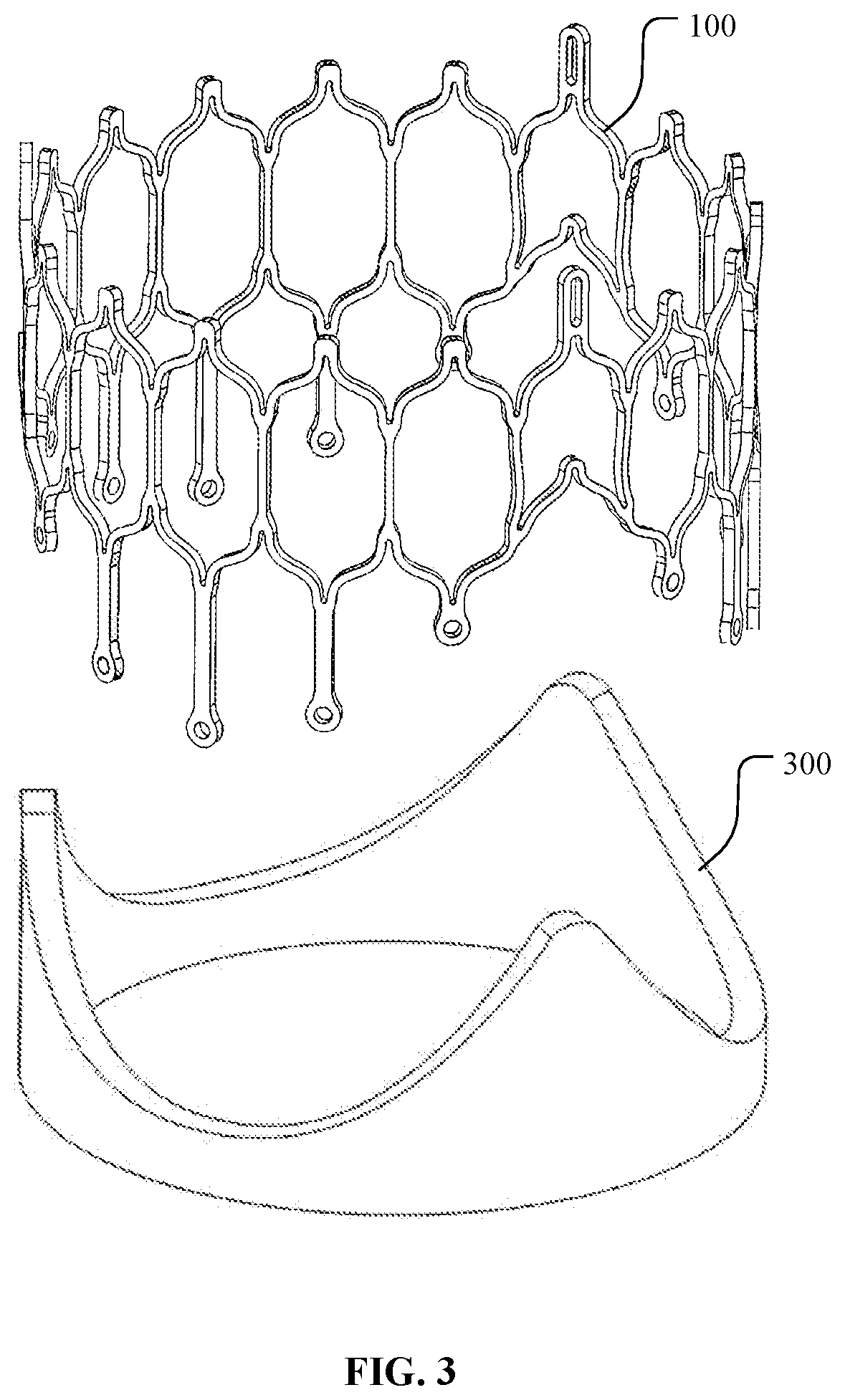 Patent US12097116 Figure 3 – Prosthetic heart valve for multiple positions and assembling method thereof