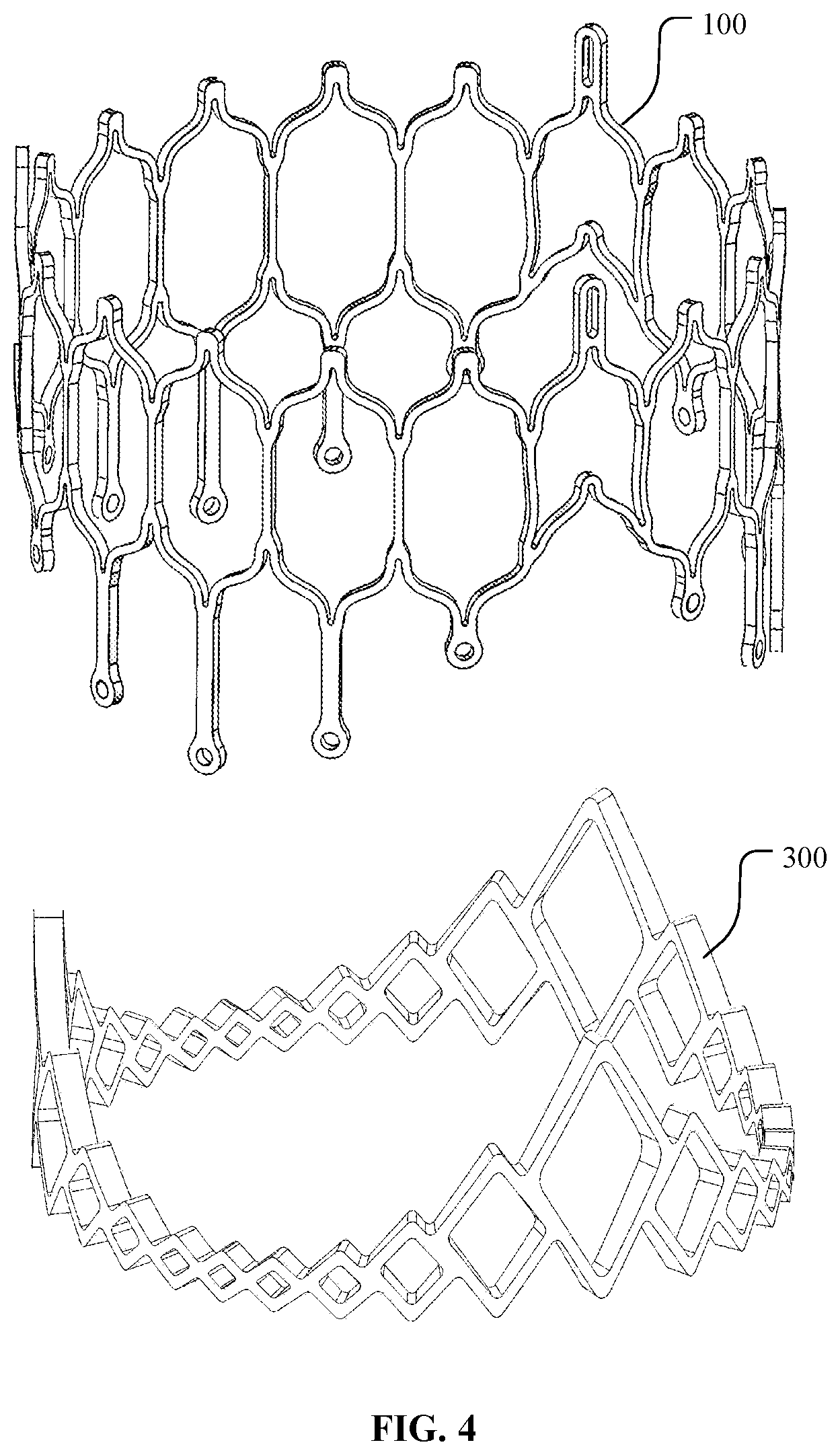 Patent US12097116 Figure 4 – Prosthetic heart valve for multiple positions and assembling method thereof