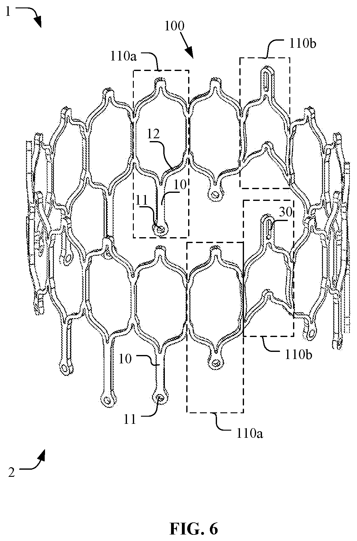 Patent US12097116 Figure 6 – Prosthetic heart valve for multiple positions and assembling method thereof