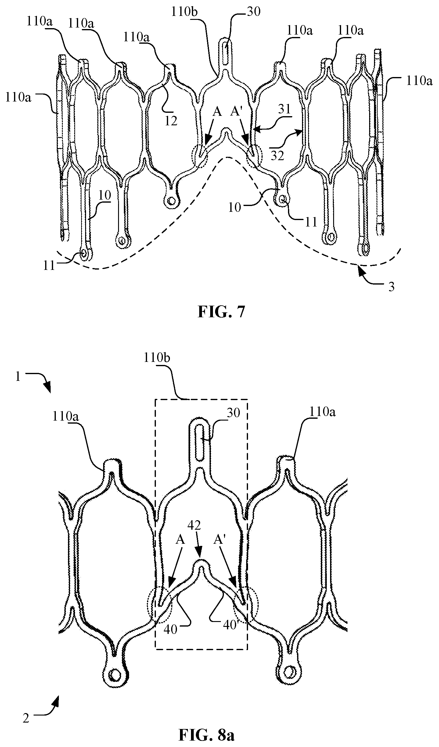 Patent US12097116 Figure 7 – Prosthetic heart valve for multiple positions and assembling method thereof