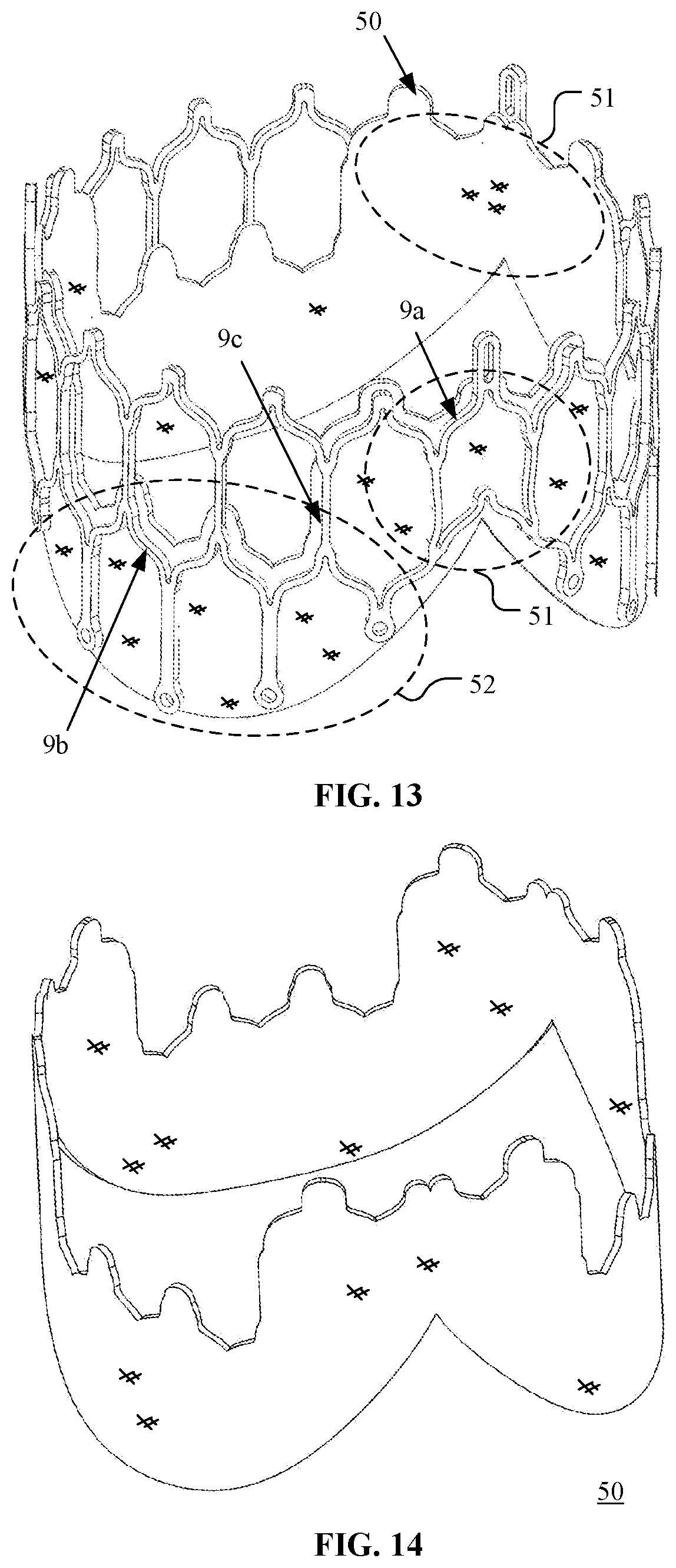 Patent US12097116 Figure 11 – Prosthetic heart valve for multiple positions and assembling method thereof