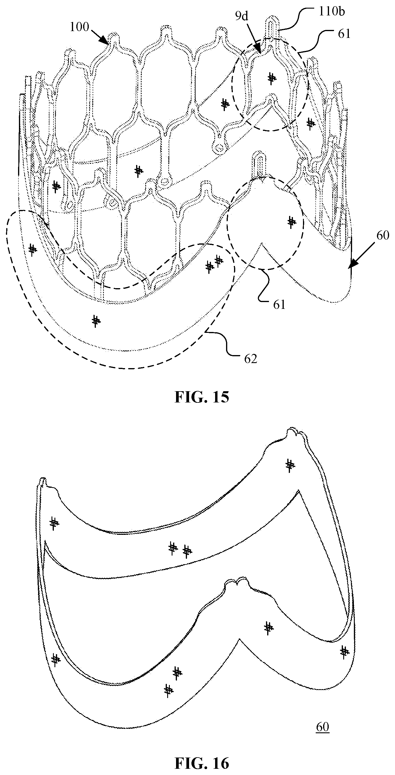 Patent US12097116 Figure 12 – Prosthetic heart valve for multiple positions and assembling method thereof