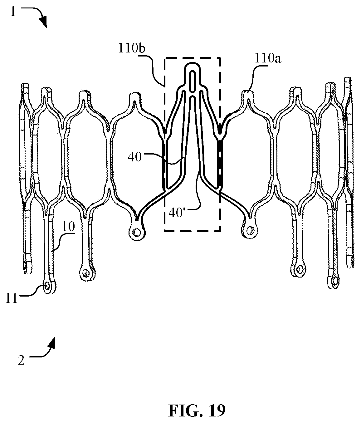 Patent US12097116 Figure 15 – Prosthetic heart valve for multiple positions and assembling method thereof