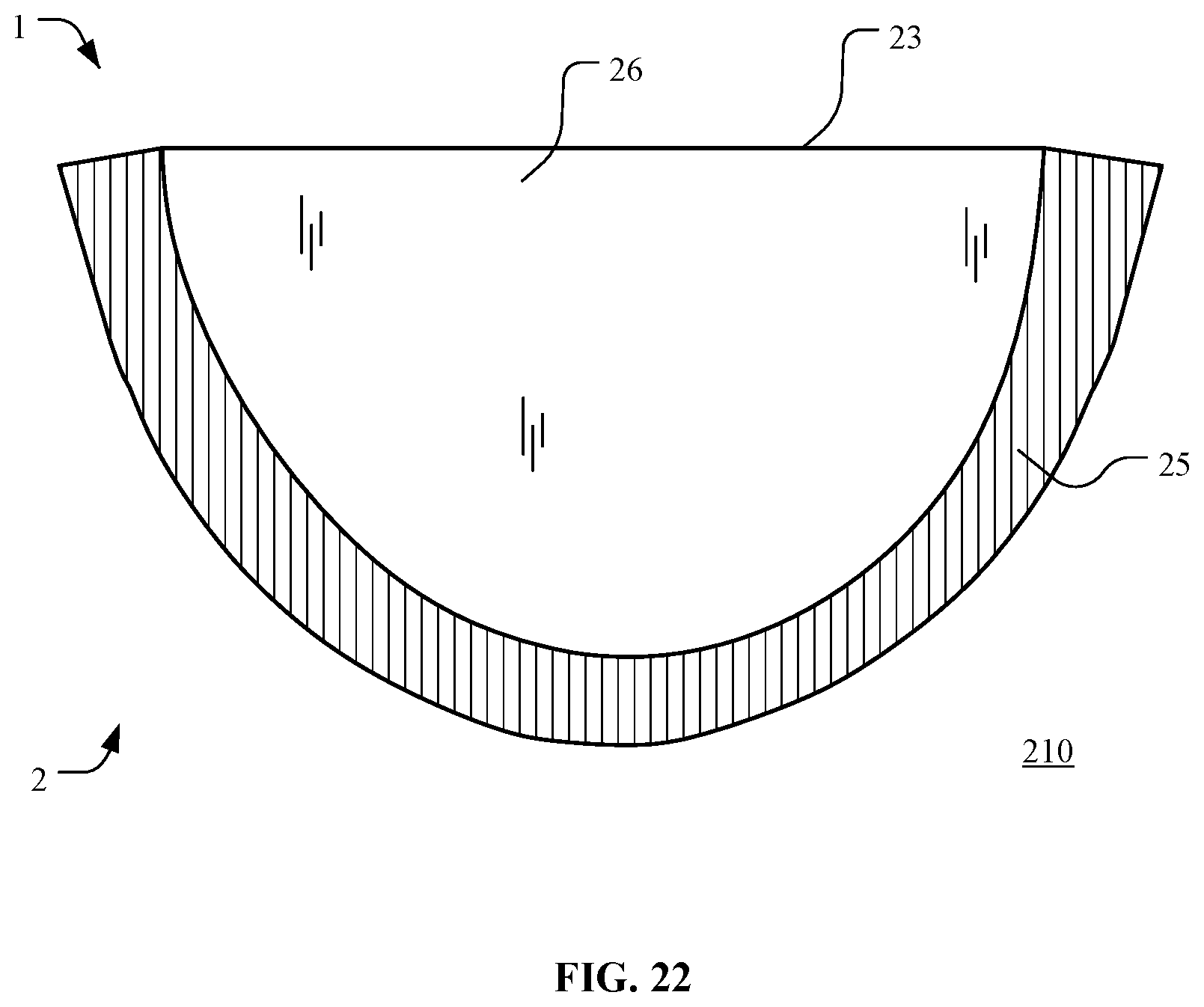 Patent US12097116 Figure 17 – Prosthetic heart valve for multiple positions and assembling method thereof
