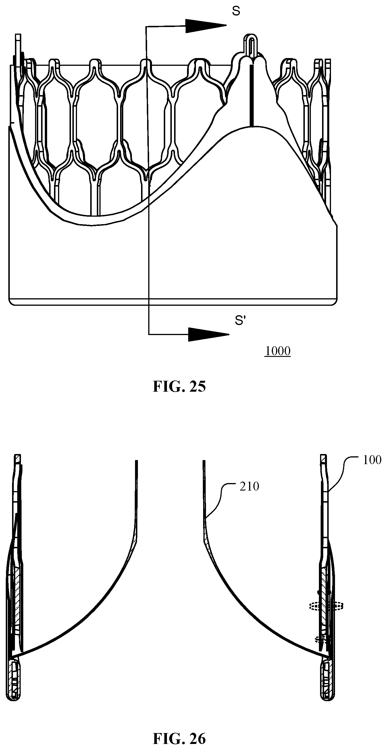 Patent US12097116 Figure 20 – Prosthetic heart valve for multiple positions and assembling method thereof